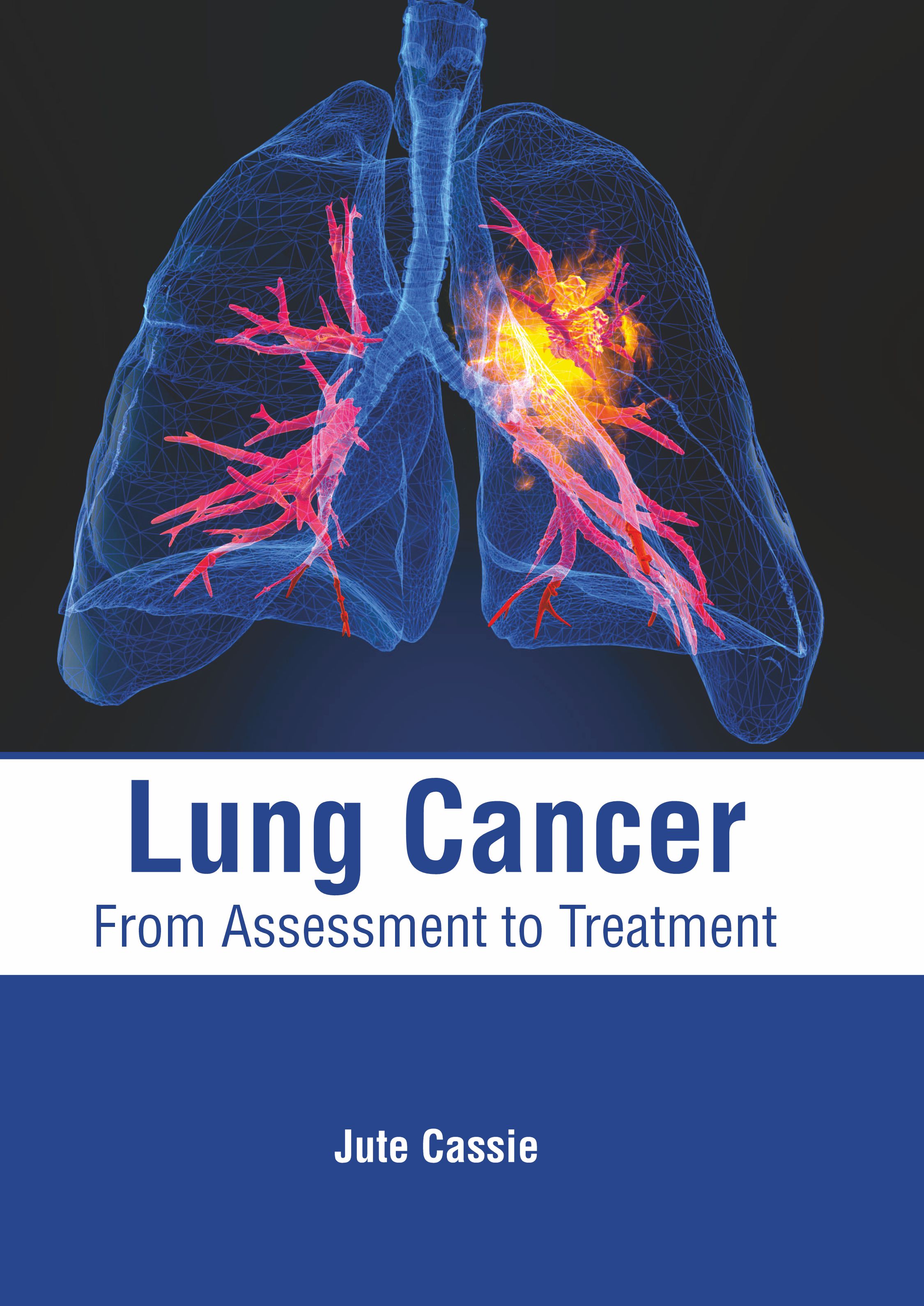 

medical-reference-books/oncology/lung-cancer-from-assessment-to-treatment-9781639273614