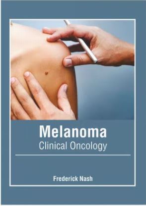 

exclusive-publishers/american-medical-publishers/melanoma-clinical-oncology-9781639273652