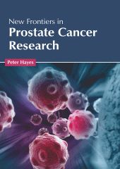 

exclusive-publishers/american-medical-publishers/new-frontiers-in-prostate-cancer-research-9781639273669