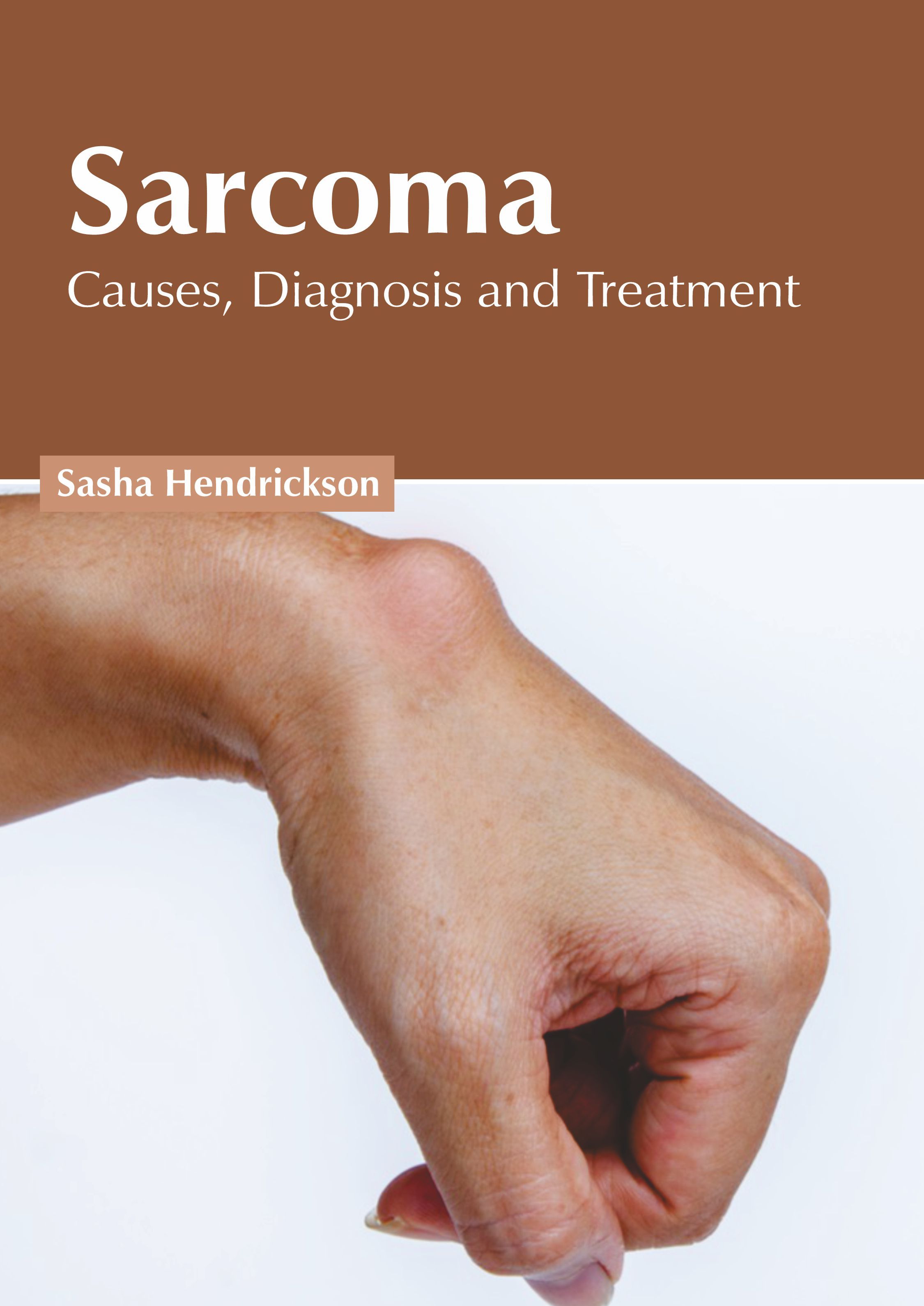 

exclusive-publishers/american-medical-publishers/sarcoma-causes-diagnosis-and-treatment-9781639273713