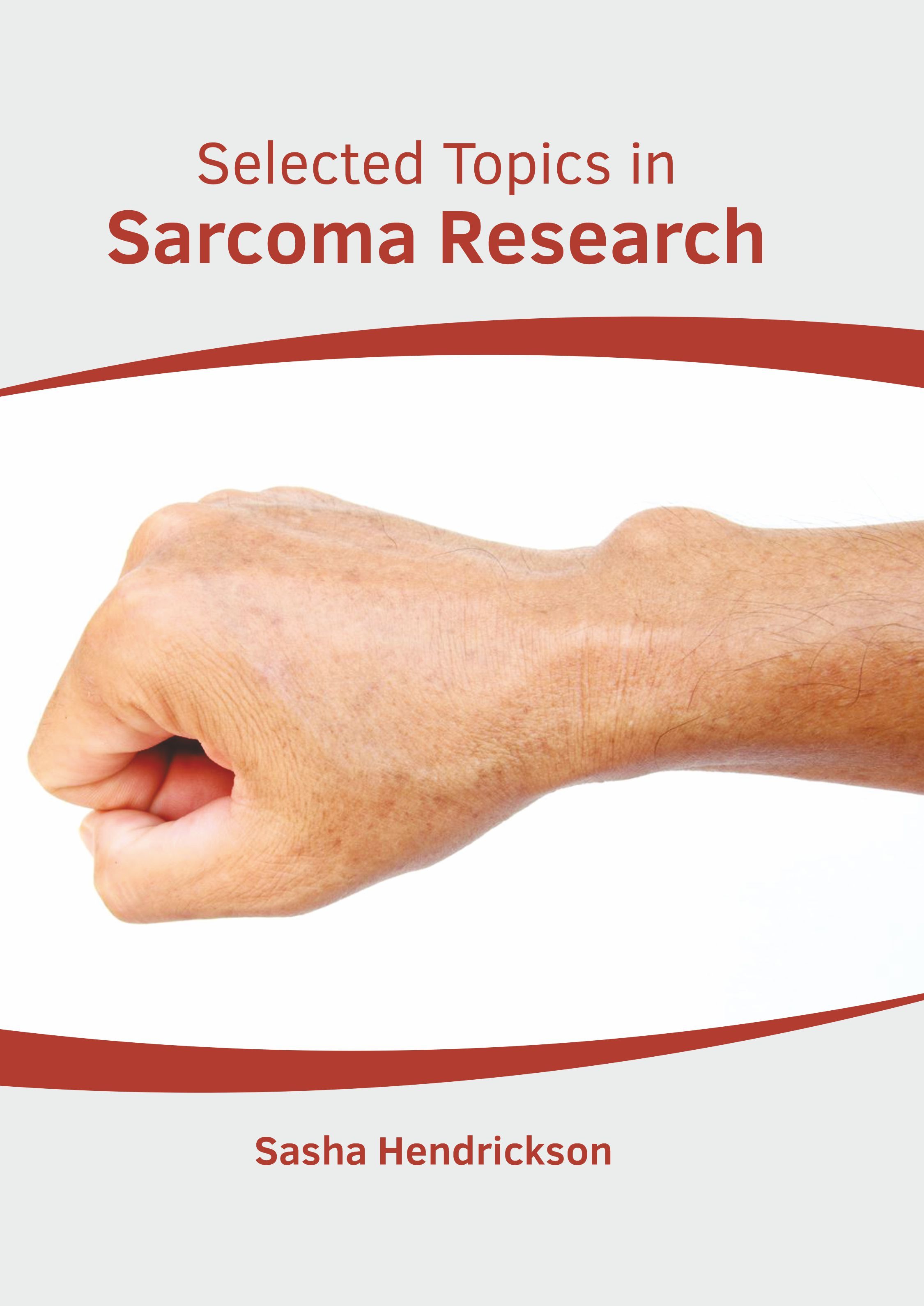 

exclusive-publishers/american-medical-publishers/selected-topics-in-sarcoma-research-9781639273751