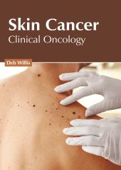 

medical-reference-books/oncology/skin-cancer-clinical-oncology-9781639273768