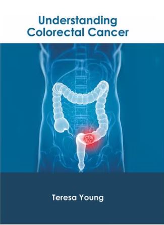 

exclusive-publishers/american-medical-publishers/understanding-colorectal-cancer-9781639273775