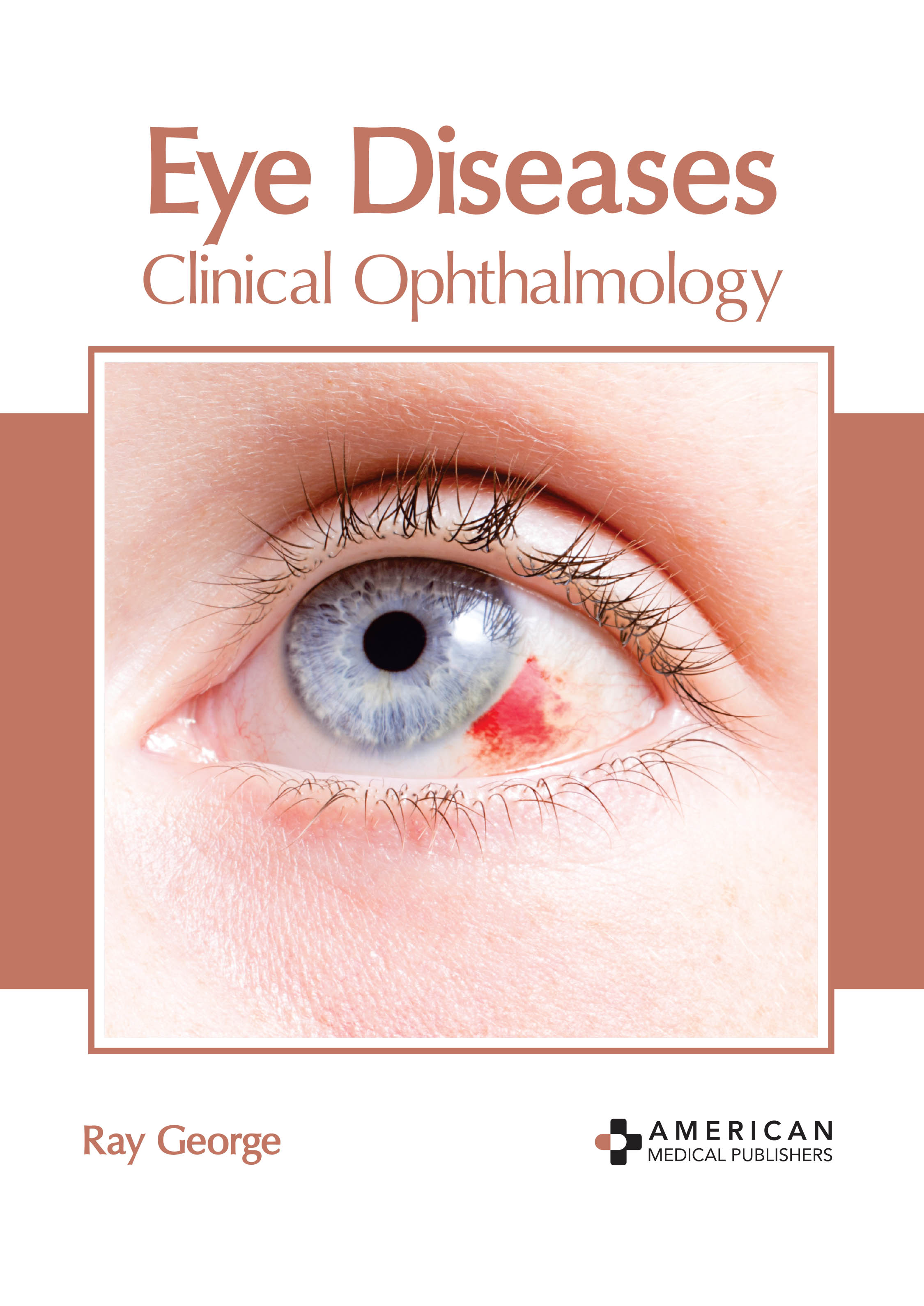 

exclusive-publishers/american-medical-publishers/eye-diseases-clinical-ophthalmology-9781639273805