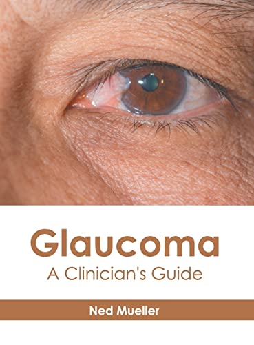 exclusive-publishers/american-medical-publishers/glaucoma-a-clinician-s-guide-9781639273829