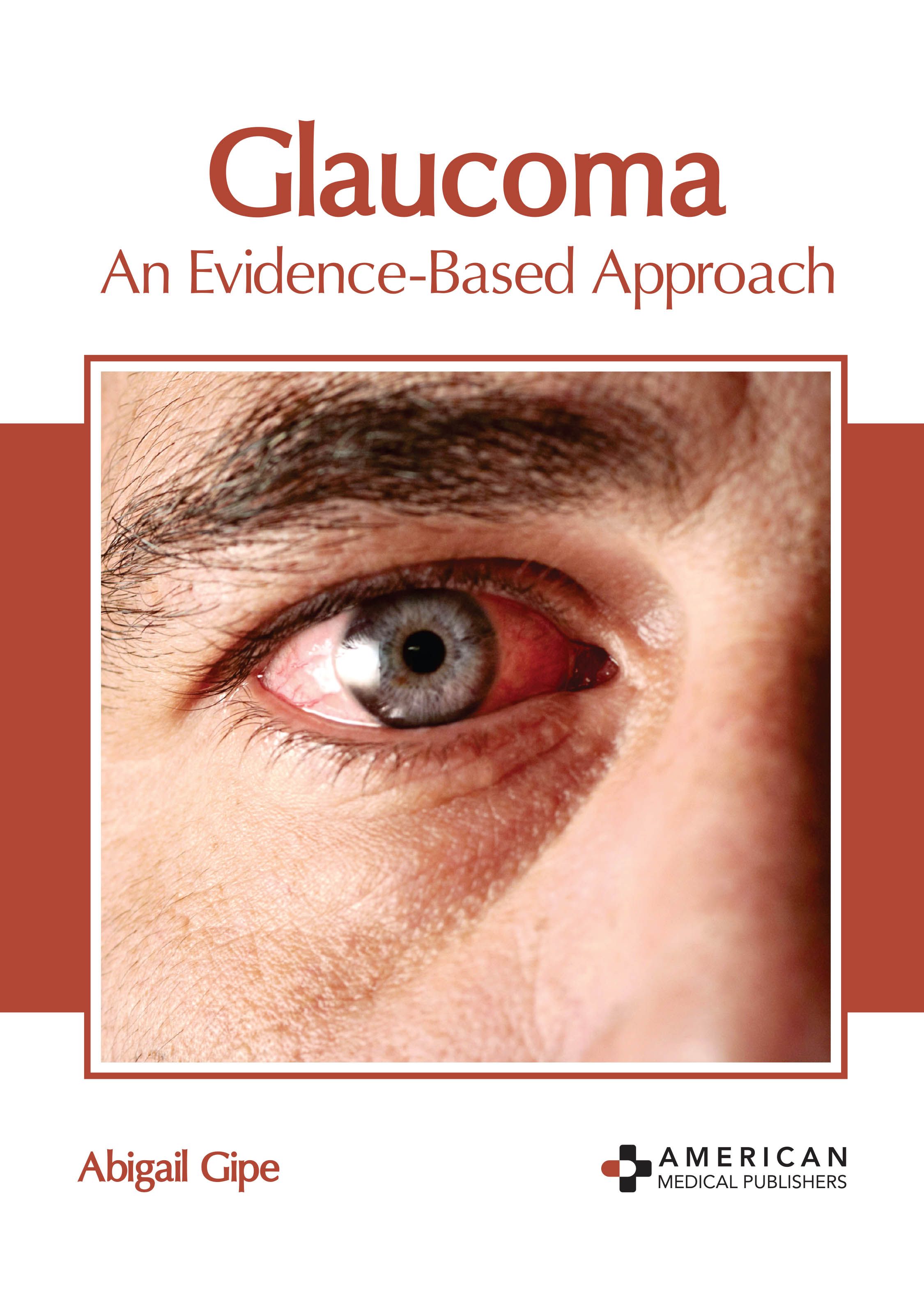 

exclusive-publishers/american-medical-publishers/glaucoma-an-evidence-based-approach-9781639273836