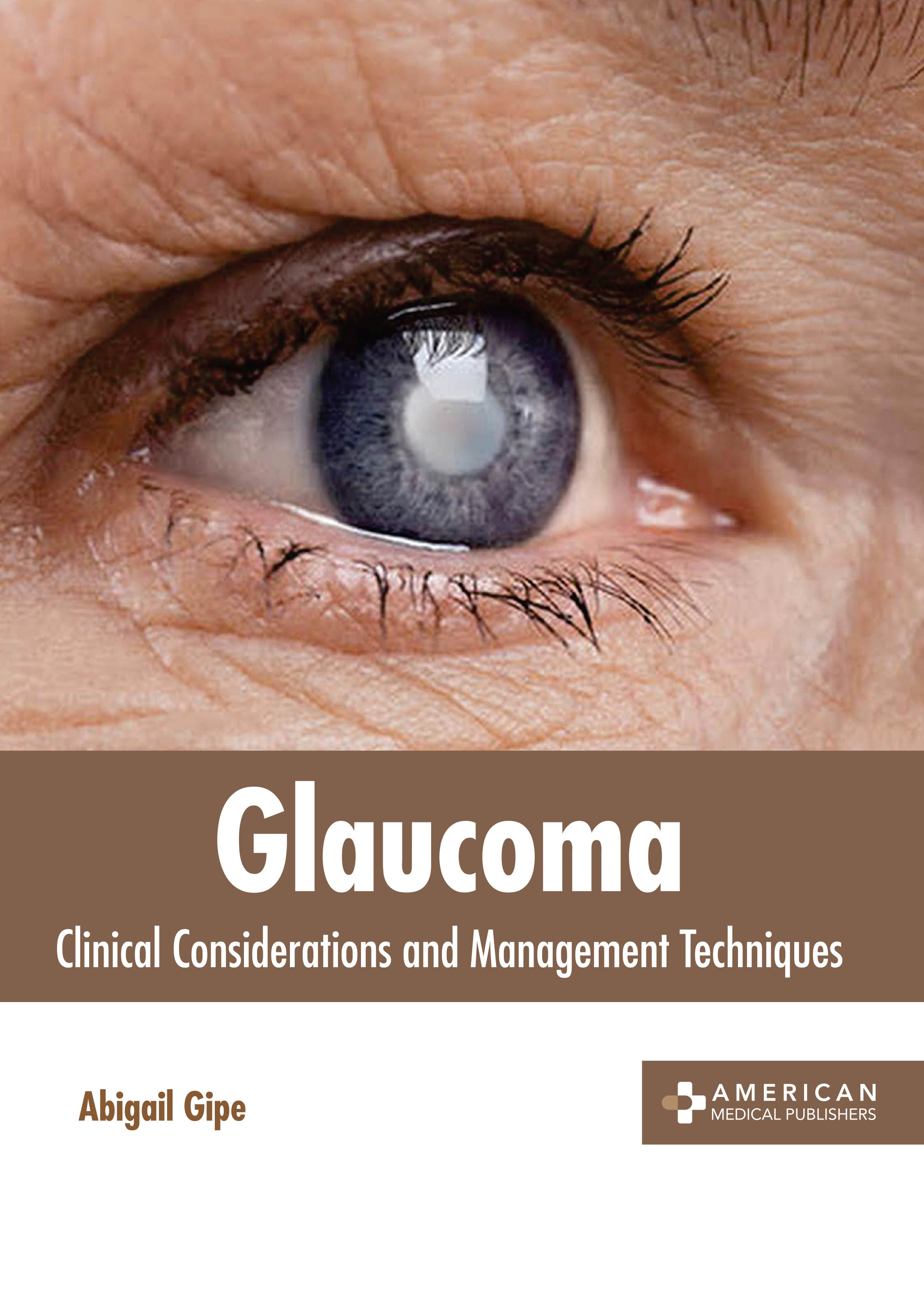 

medical-reference-books/ophthalmology/glaucoma-current-practices-in-ophthalmology-9781639273843