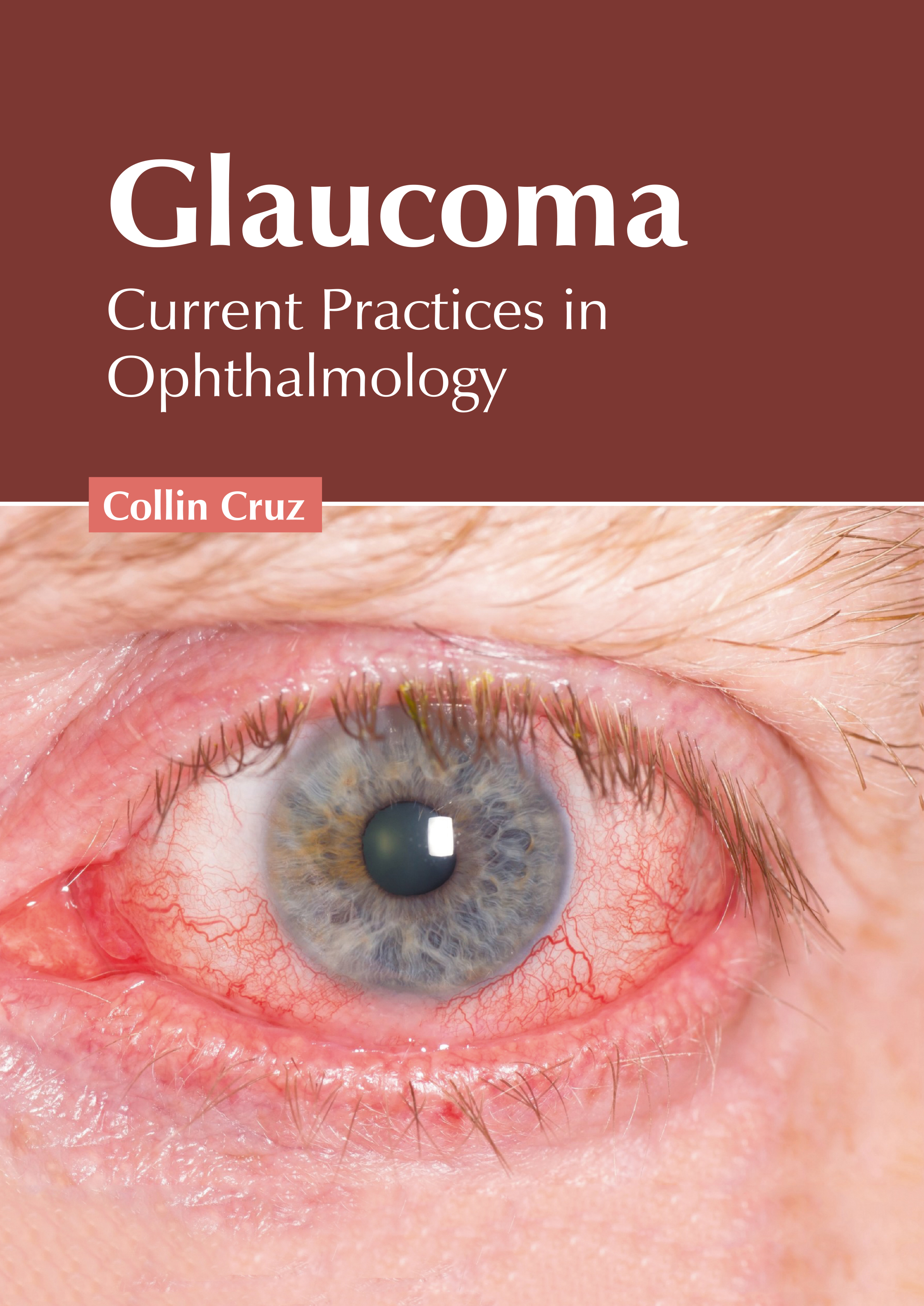 

exclusive-publishers/american-medical-publishers/glaucoma-current-practices-in-ophthalmology-9781639273850