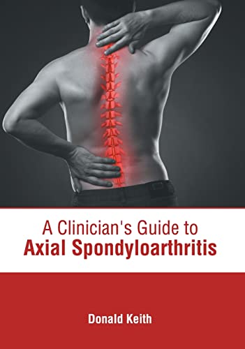 exclusive-publishers/american-medical-publishers/a-clinician-s-guide-to-axial-spondyloarthritis-9781639273898