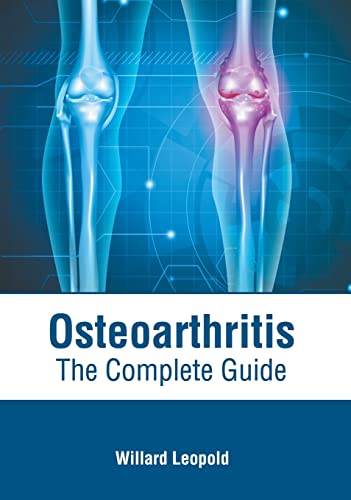 

exclusive-publishers/american-medical-publishers/osteoarthritis-the-complete-guide-9781639274024