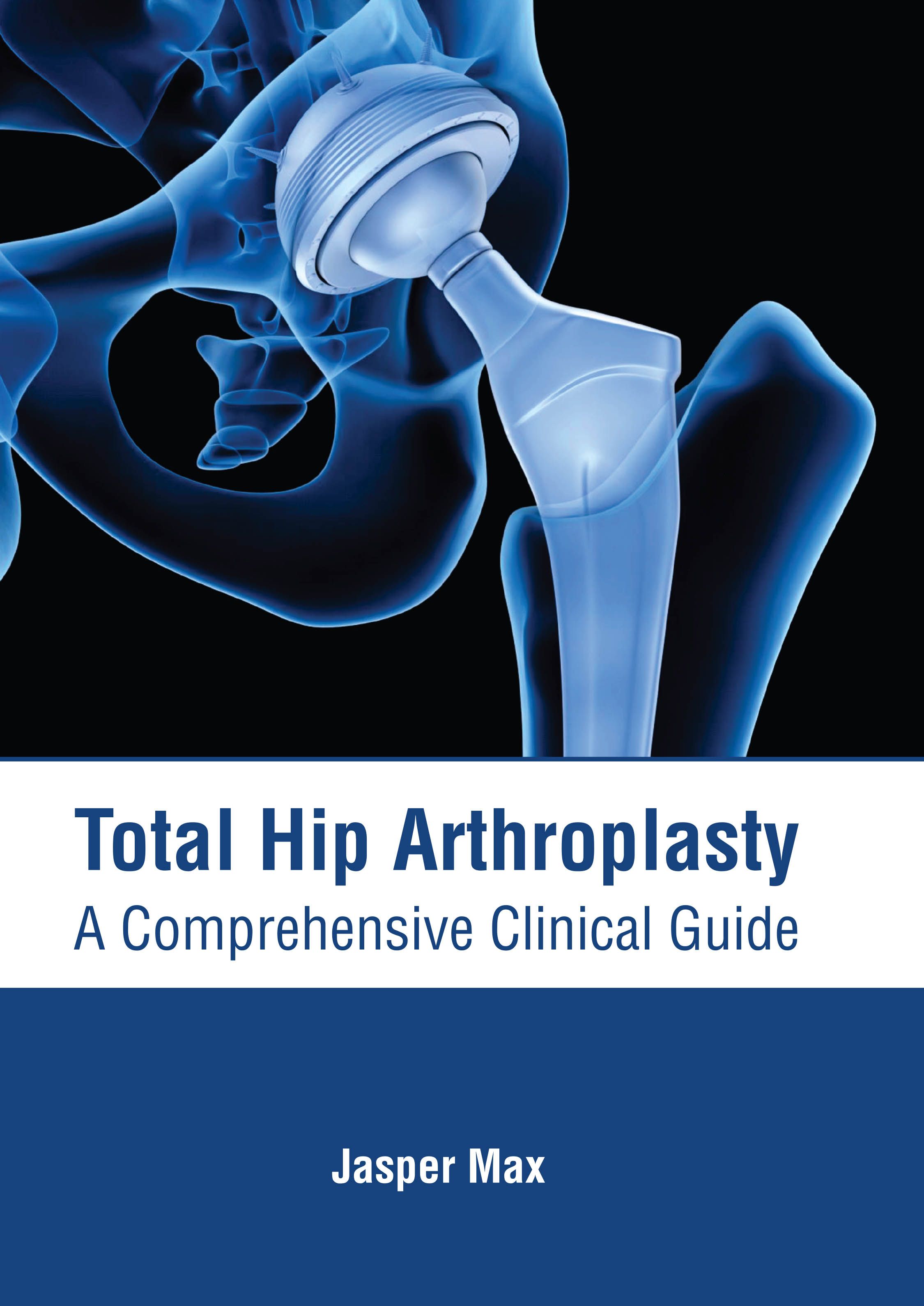 exclusive-publishers/american-medical-publishers/total-hip-arthroplasty-a-comprehensive-clinical-guide-9781639274048
