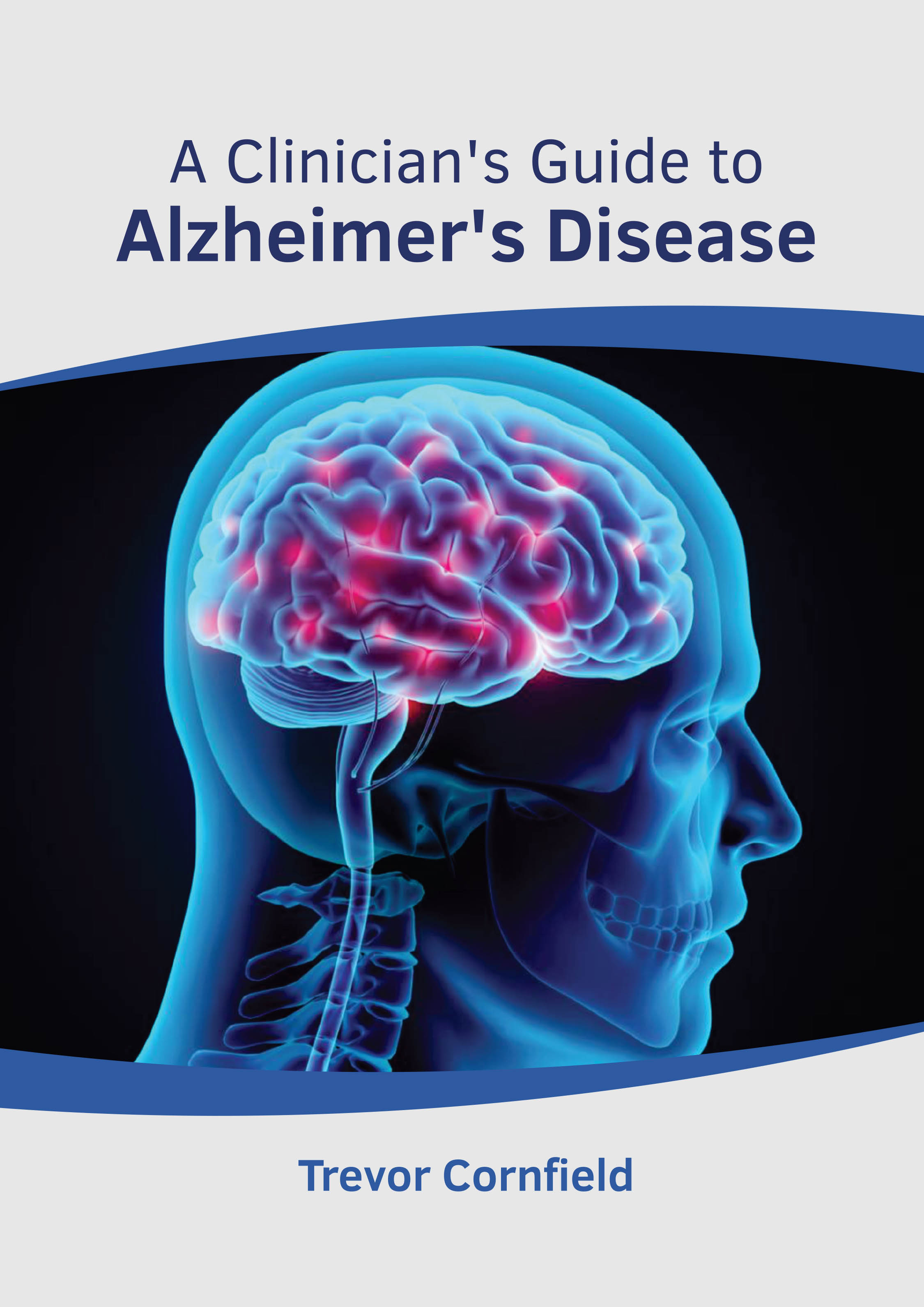 

exclusive-publishers/american-medical-publishers/a-clinician-s-guide-to-alzheimer-s-disease-9781639274321