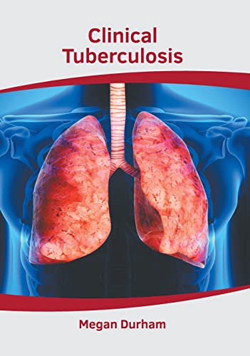 medical-reference-books/respiratory-medicine/handbook-of-pulmonary-medicine-9781639274581