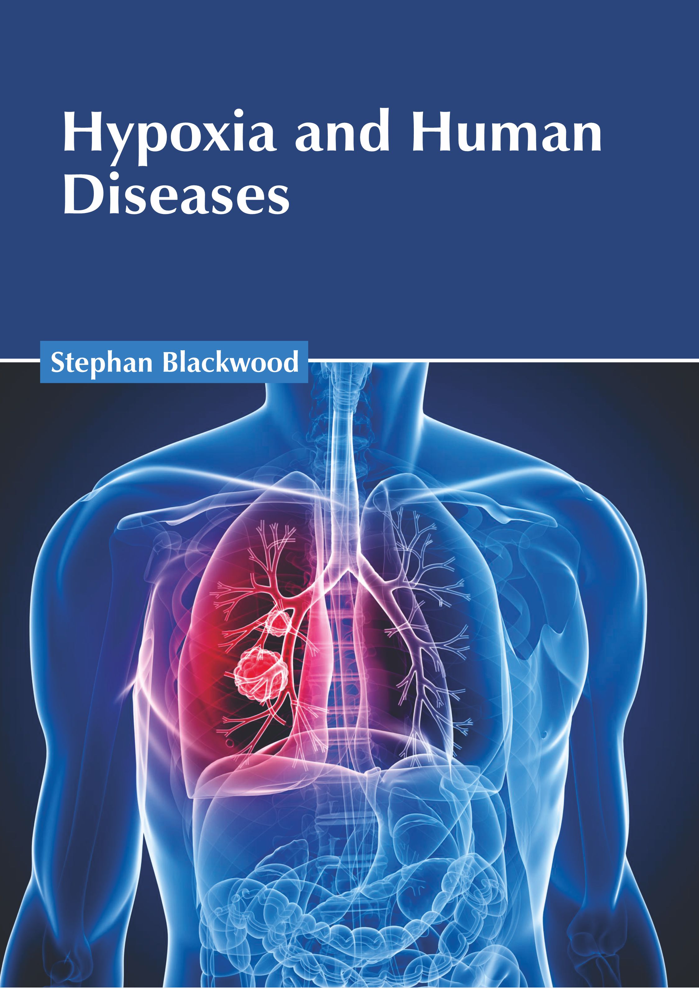 

exclusive-publishers/american-medical-publishers/hypoxia-and-human-diseases-9781639274604