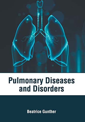 

exclusive-publishers/american-medical-publishers/pulmonary-diseases-and-disorders-9781639274628