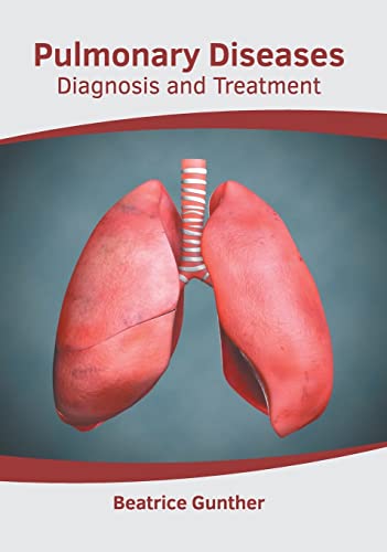 

exclusive-publishers/american-medical-publishers/pulmonary-diseases-diagnosis-and-treatment-9781639274635