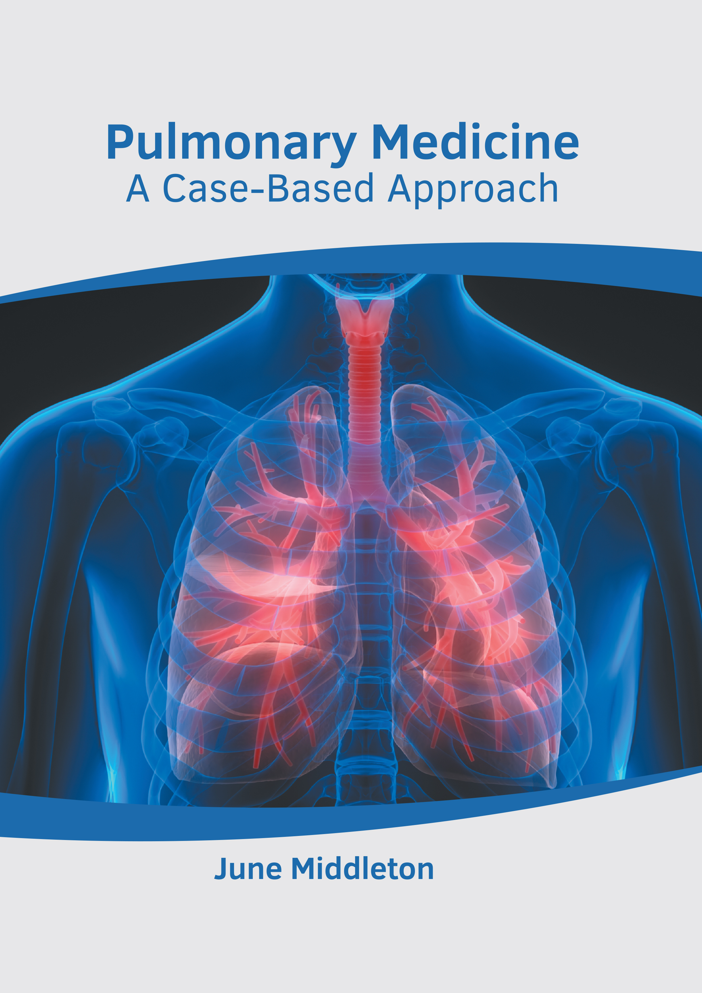 

exclusive-publishers/american-medical-publishers/pulmonary-medicine-a-case-based-approach-9781639274642