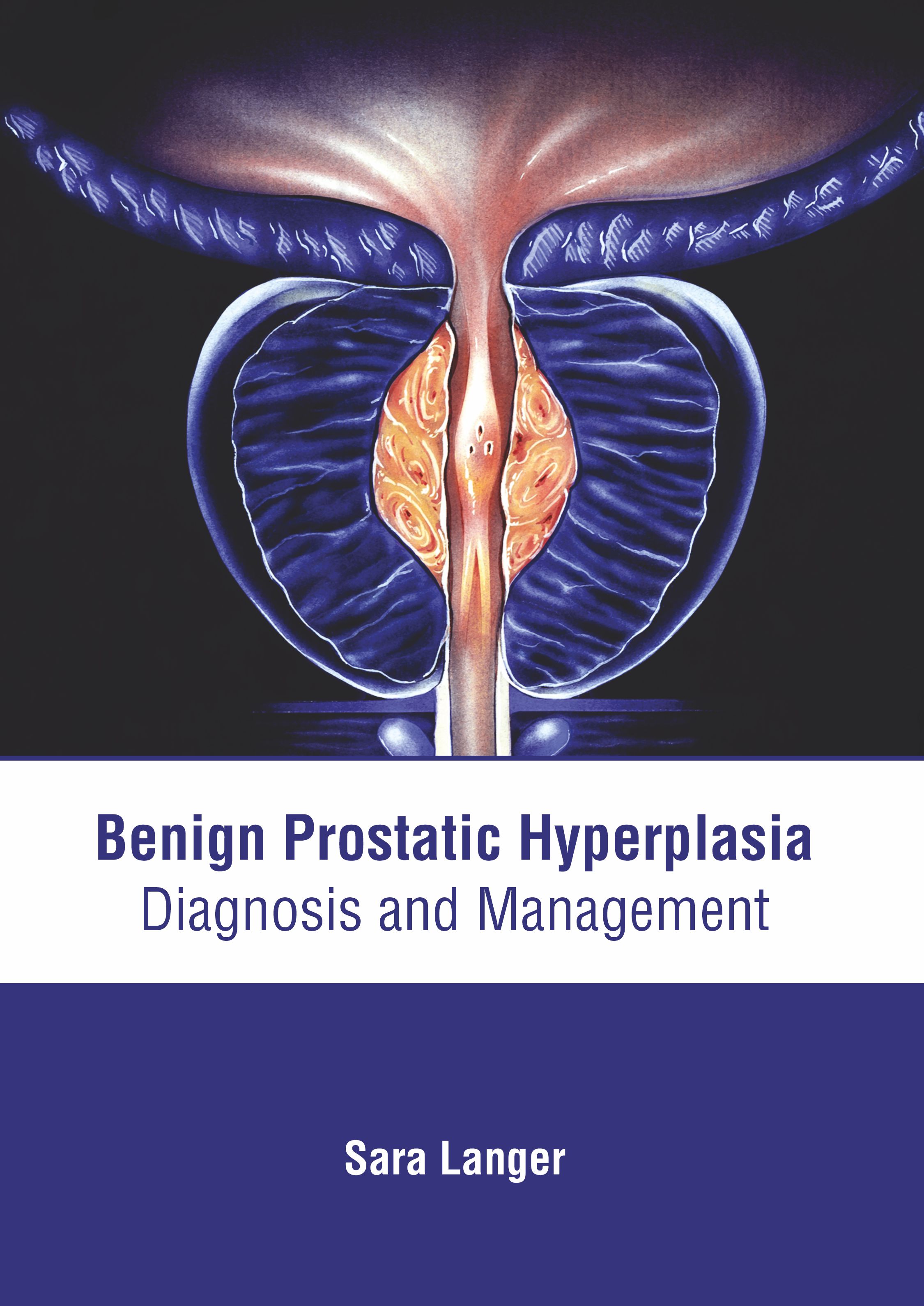 

exclusive-publishers/american-medical-publishers/benign-prostatic-hyperplasia-diagnosis-and-management-9781639275090