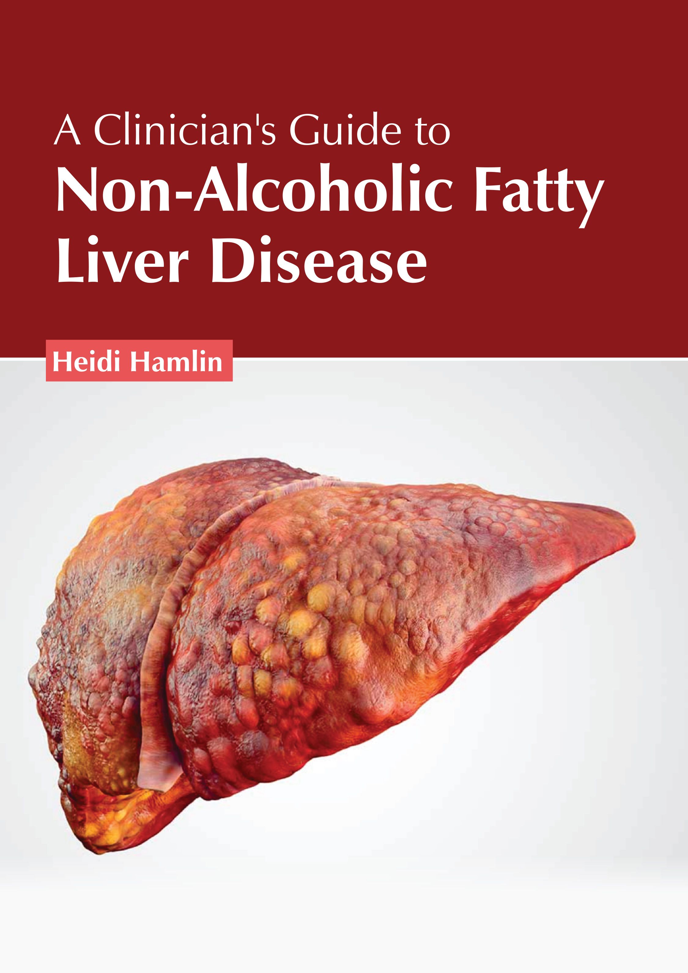 

exclusive-publishers/american-medical-publishers/a-clinician-s-guide-to-non-alcoholic-fatty-liver-disease-9781639275779