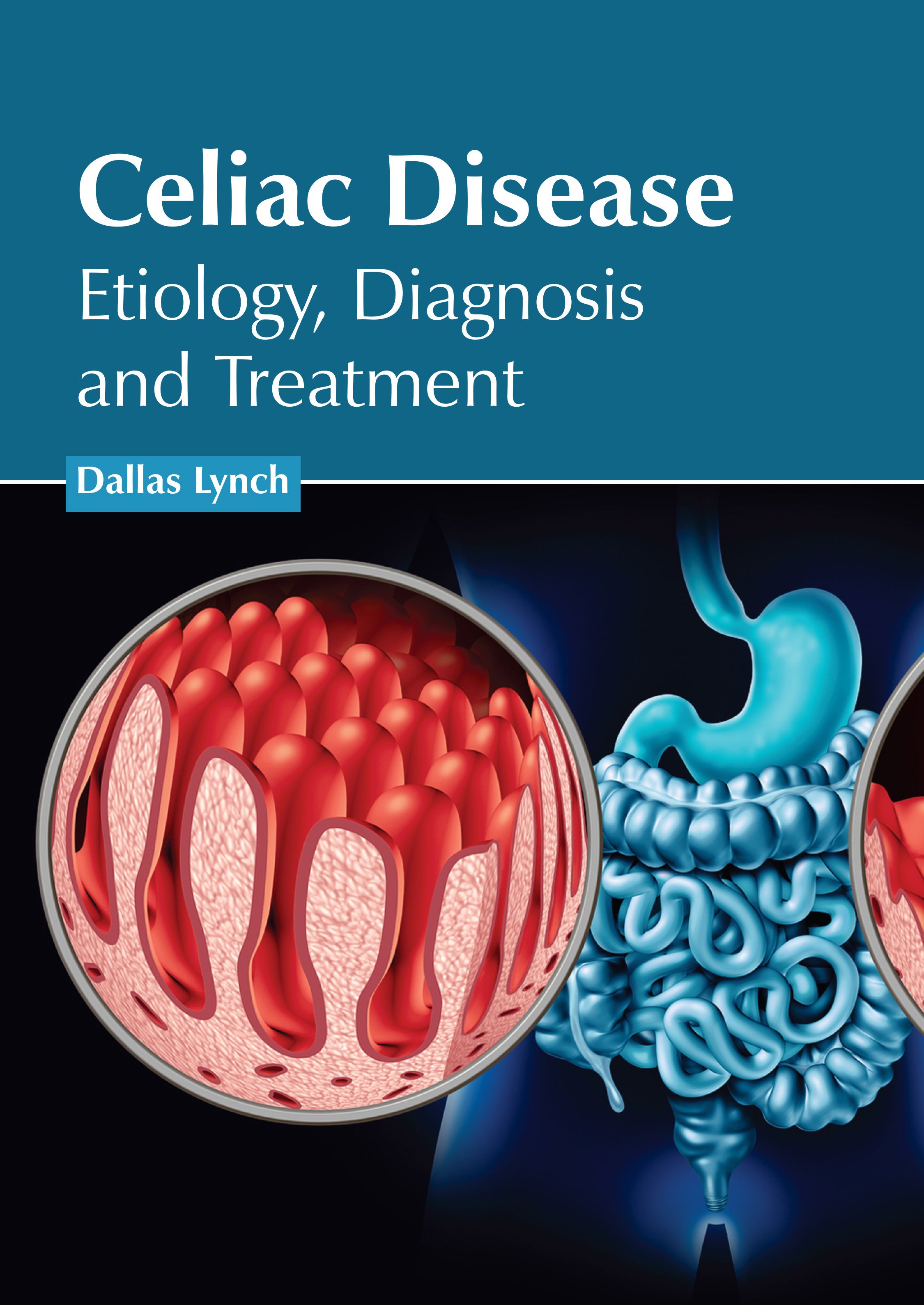 

medical-reference-books/gastroenterology/celiac-disease-etiology-diagnosis-and-treatment-9781639276240