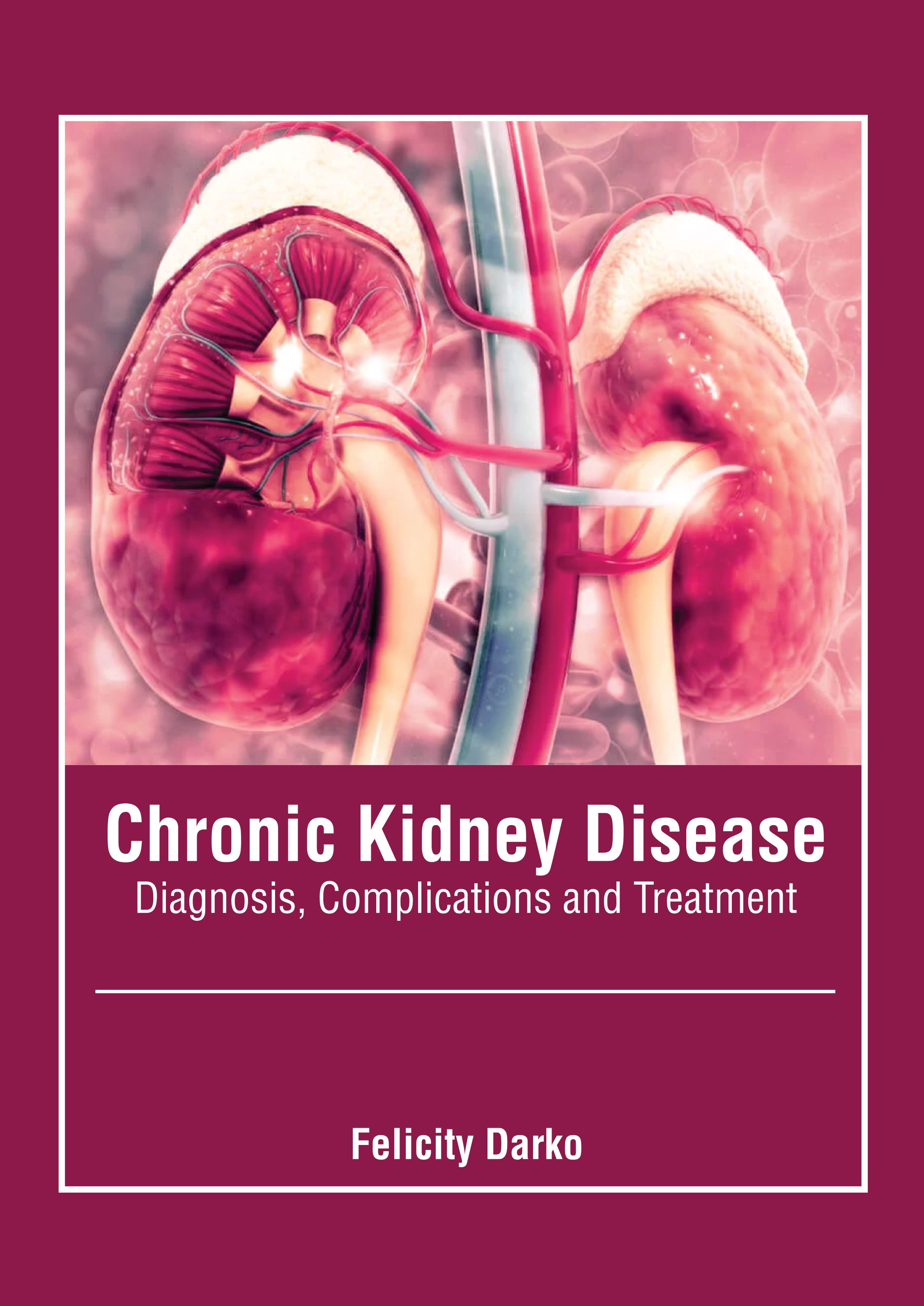 

exclusive-publishers/american-medical-publishers/chronic-kidney-disease-diagnosis-complications-and-treatment-9781639276301