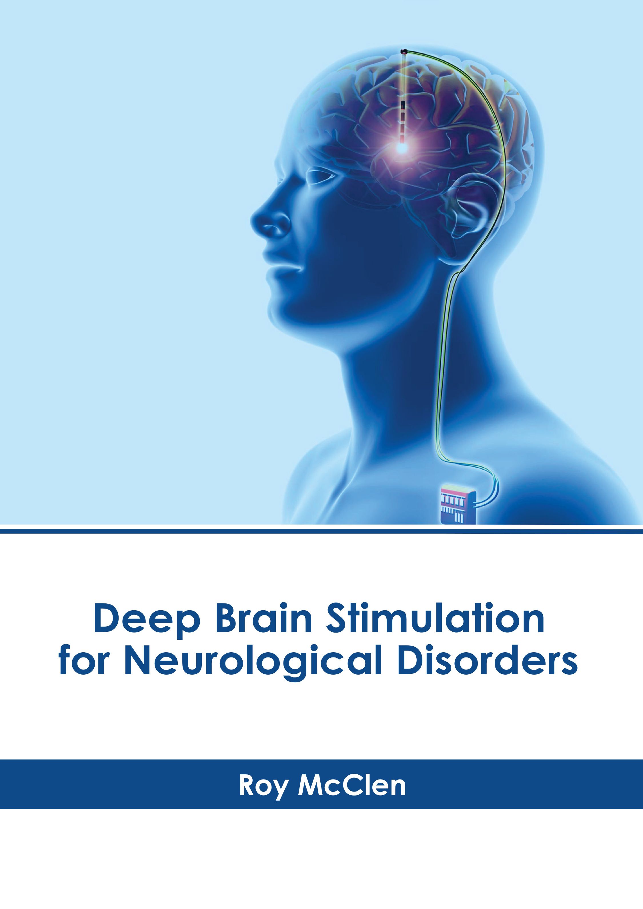 

exclusive-publishers/american-medical-publishers/deep-brain-stimulation-for-neurological-disorders-9781639276516