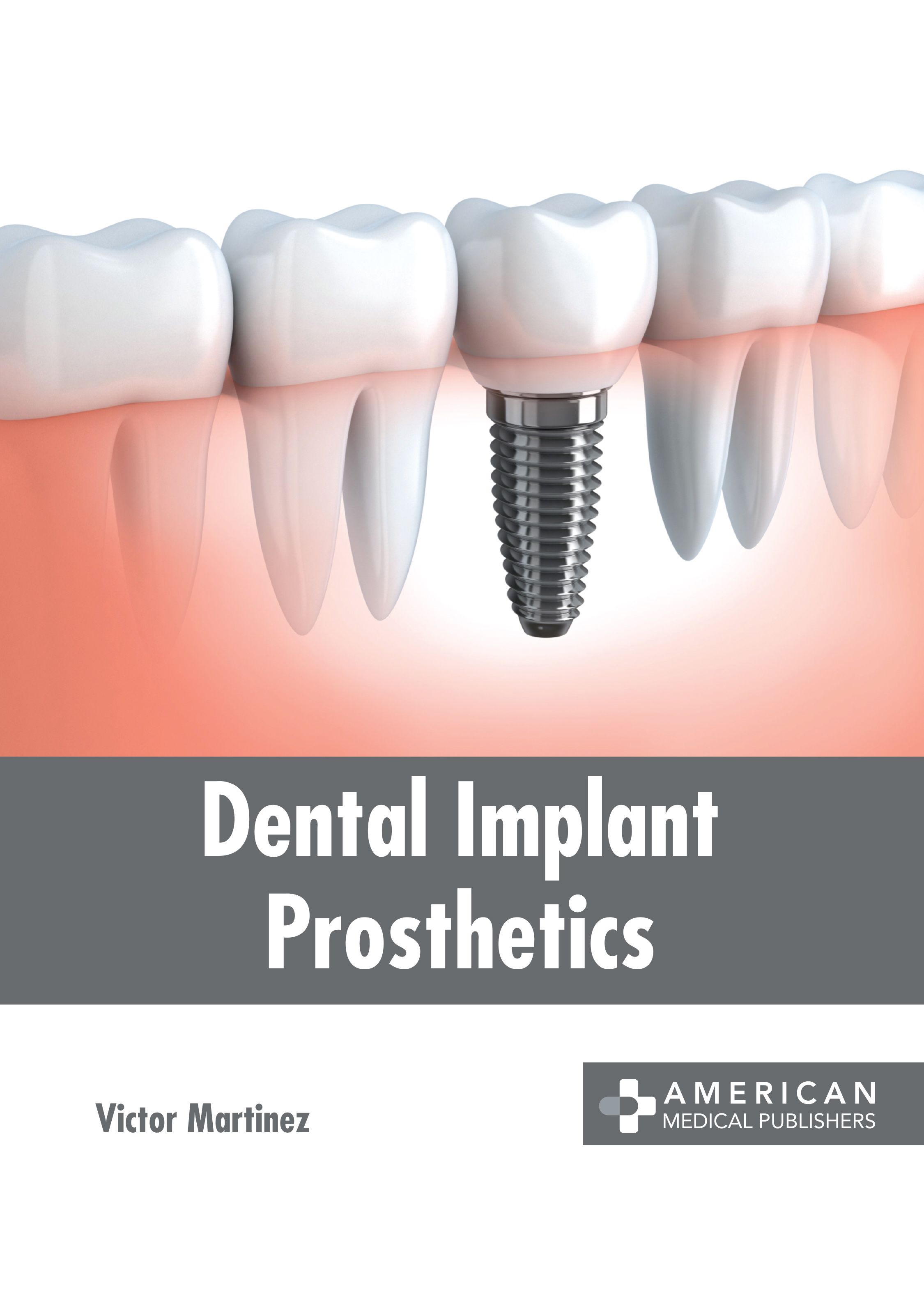 

exclusive-publishers/american-medical-publishers/dental-implant-prosthetics-9781639276523