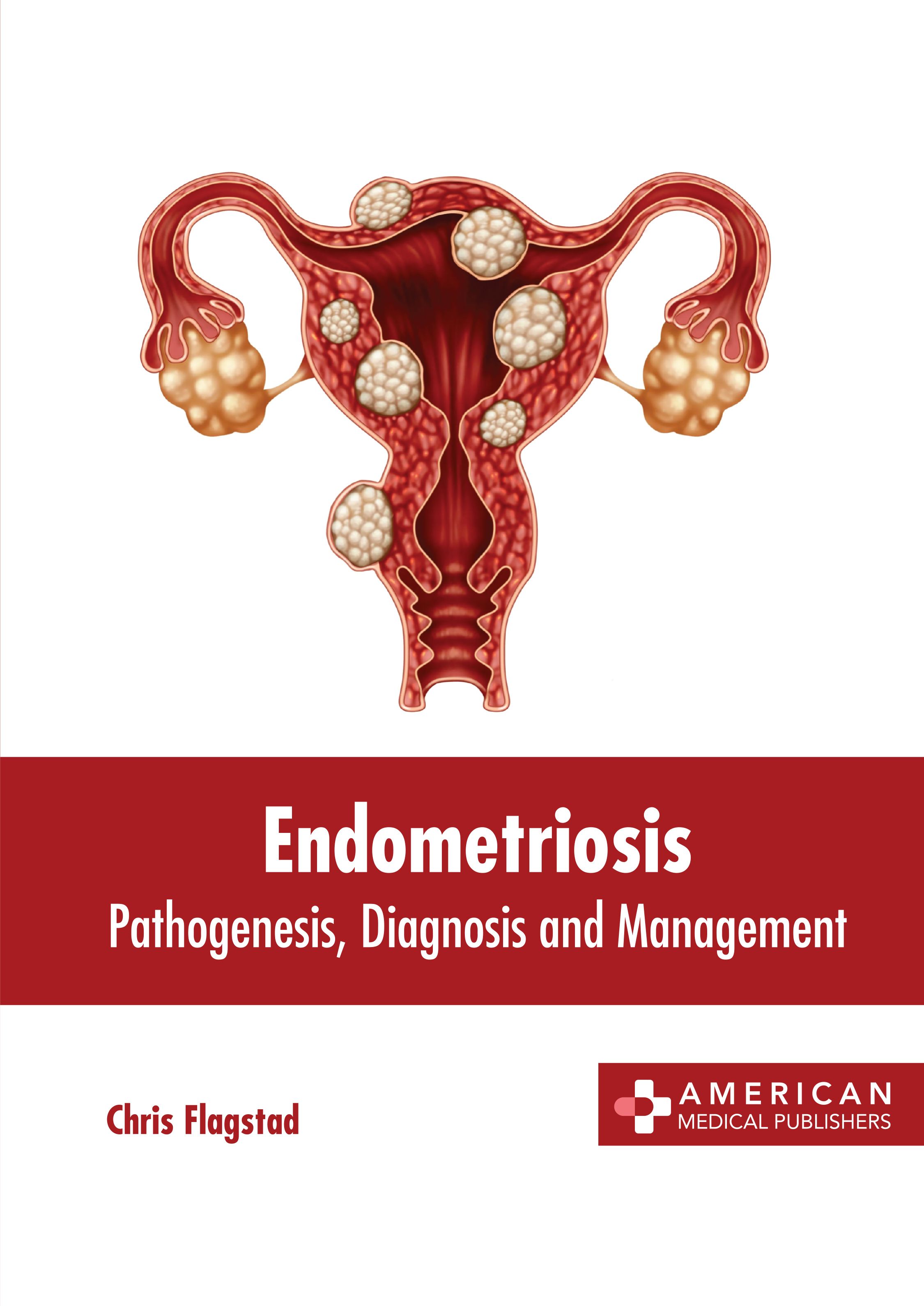 

exclusive-publishers/american-medical-publishers/endometriosis-pathogenesis-diagnosis-and-management-9781639276677