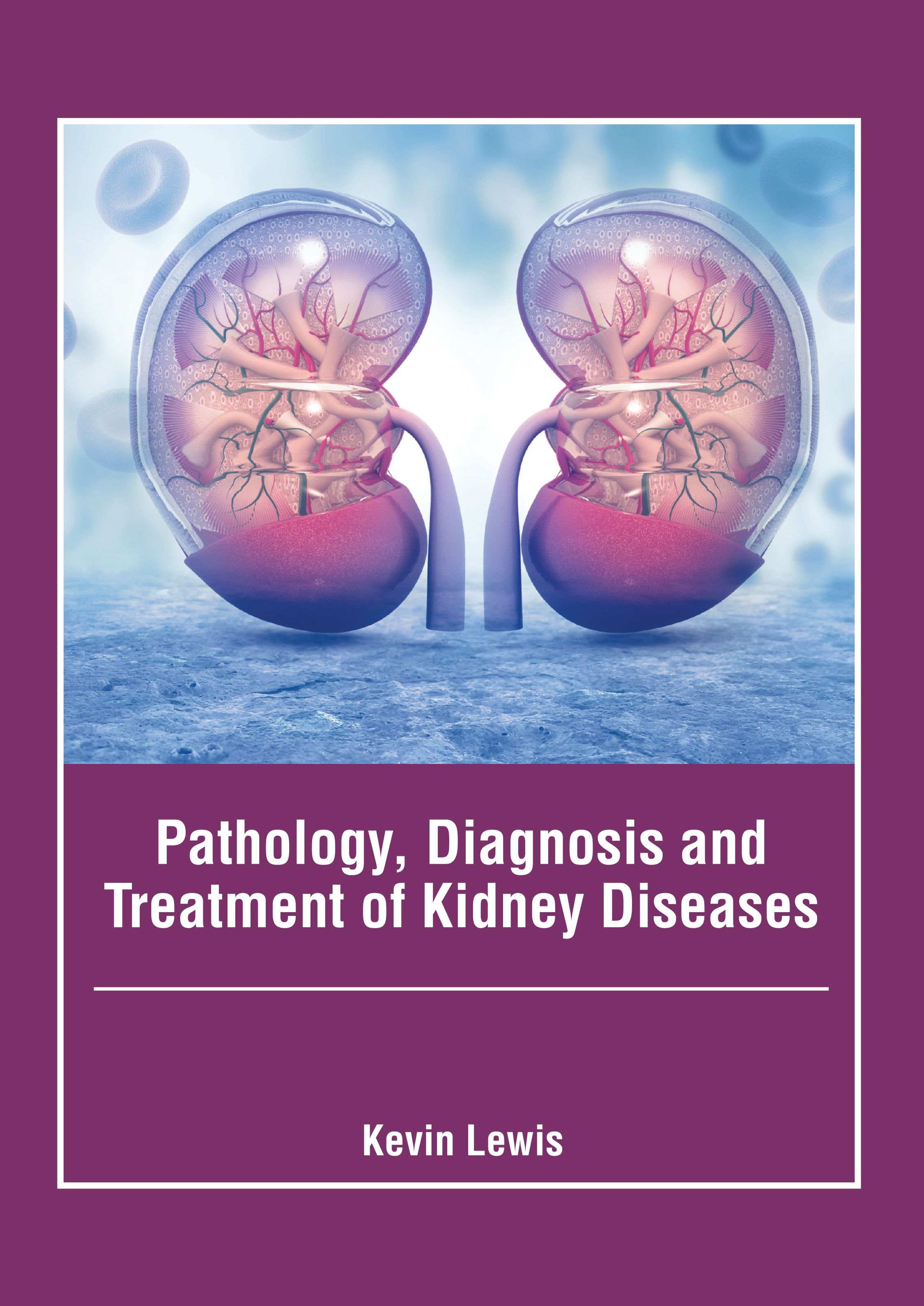 

exclusive-publishers/american-medical-publishers/pathology-diagnosis-and-treatment-of-kidney-diseases-9781639277117