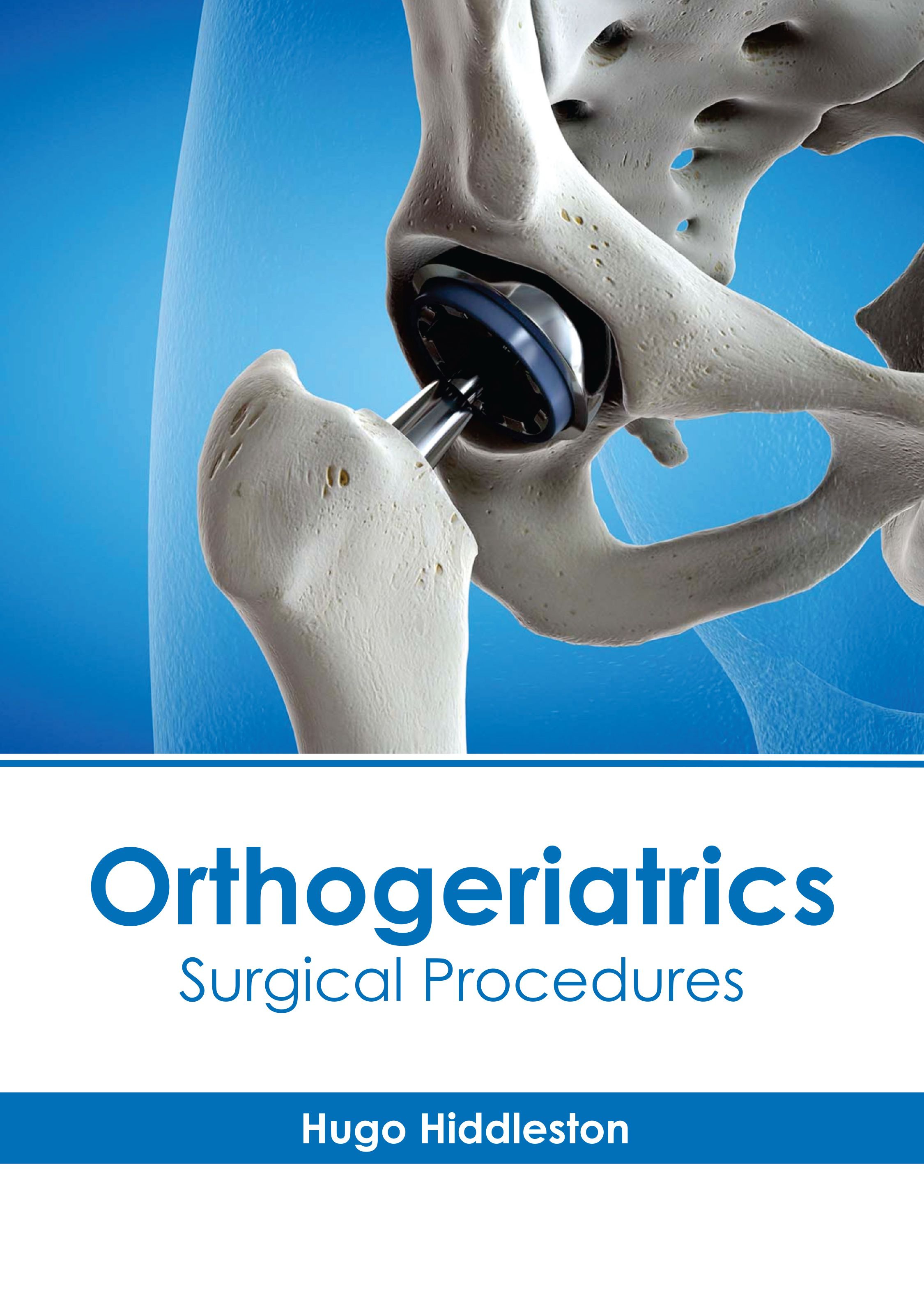 

medical-reference-books/orthopaedics/orthopedic-biomaterials-in-research-and-practice-9781639277742