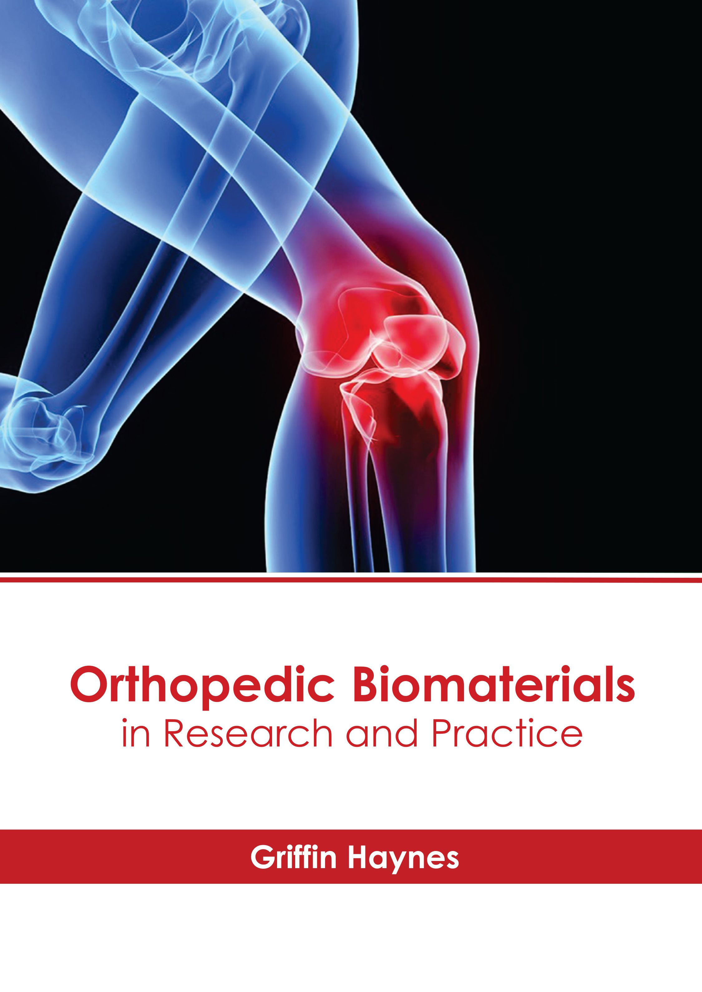 

medical-reference-books/orthopaedics/osteoarthritis-causes-symptoms-and-management-9781639277759
