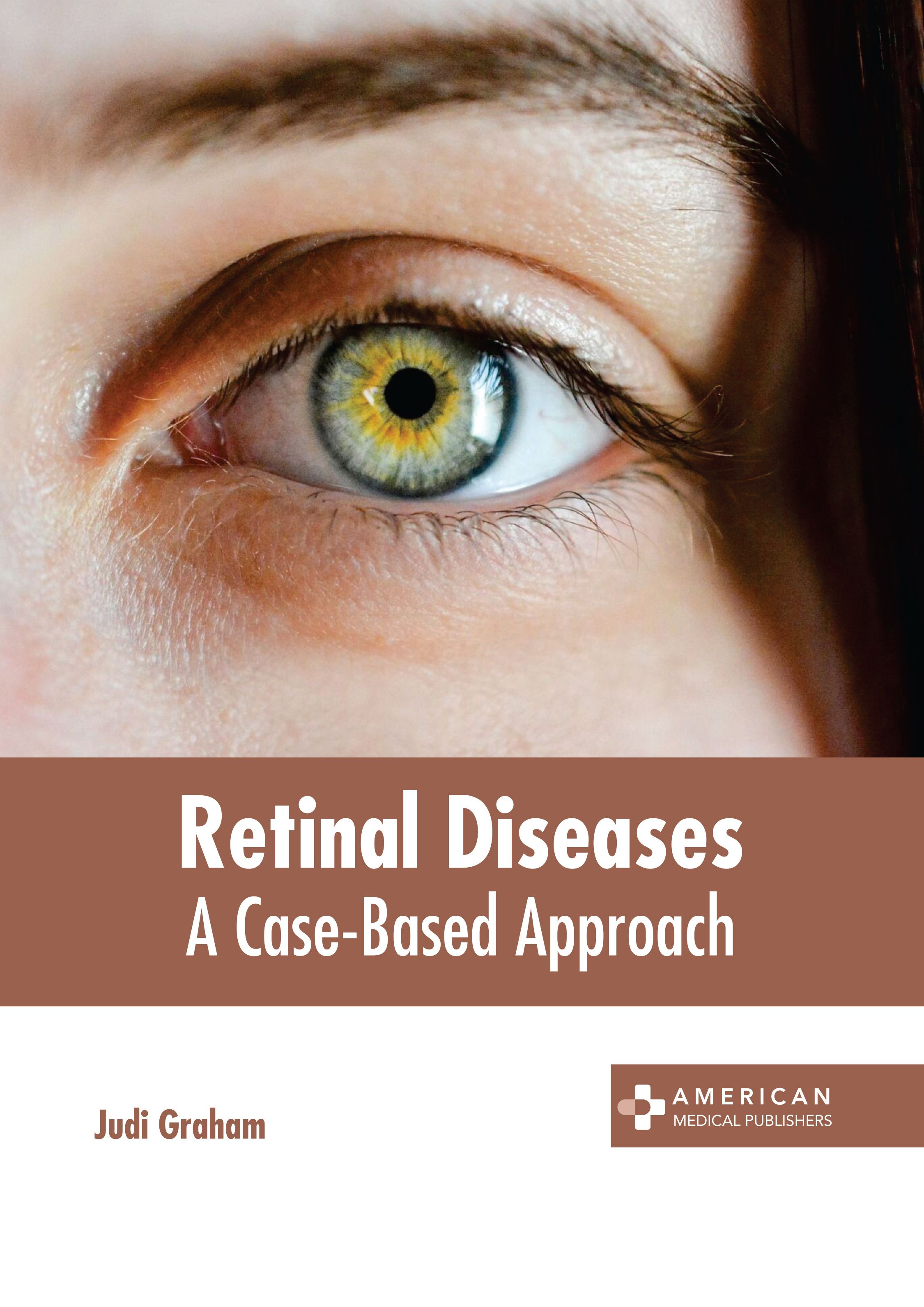 exclusive-publishers/american-medical-publishers/retinal-diseases-a-case-based-approach-9781639277971