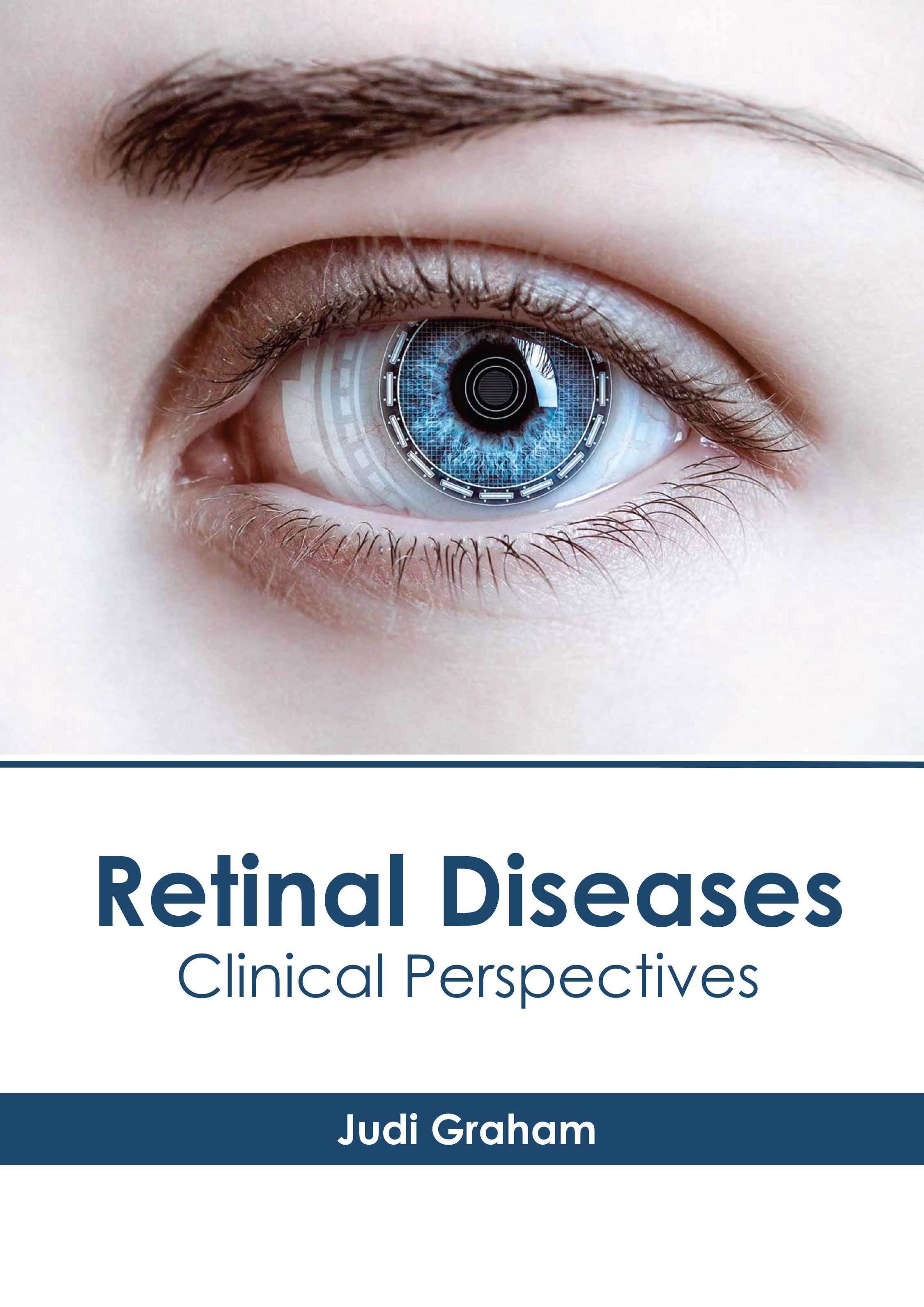 

medical-reference-books/ophthalmology/retinal-diseases-clinical-perspectives-9781639277988