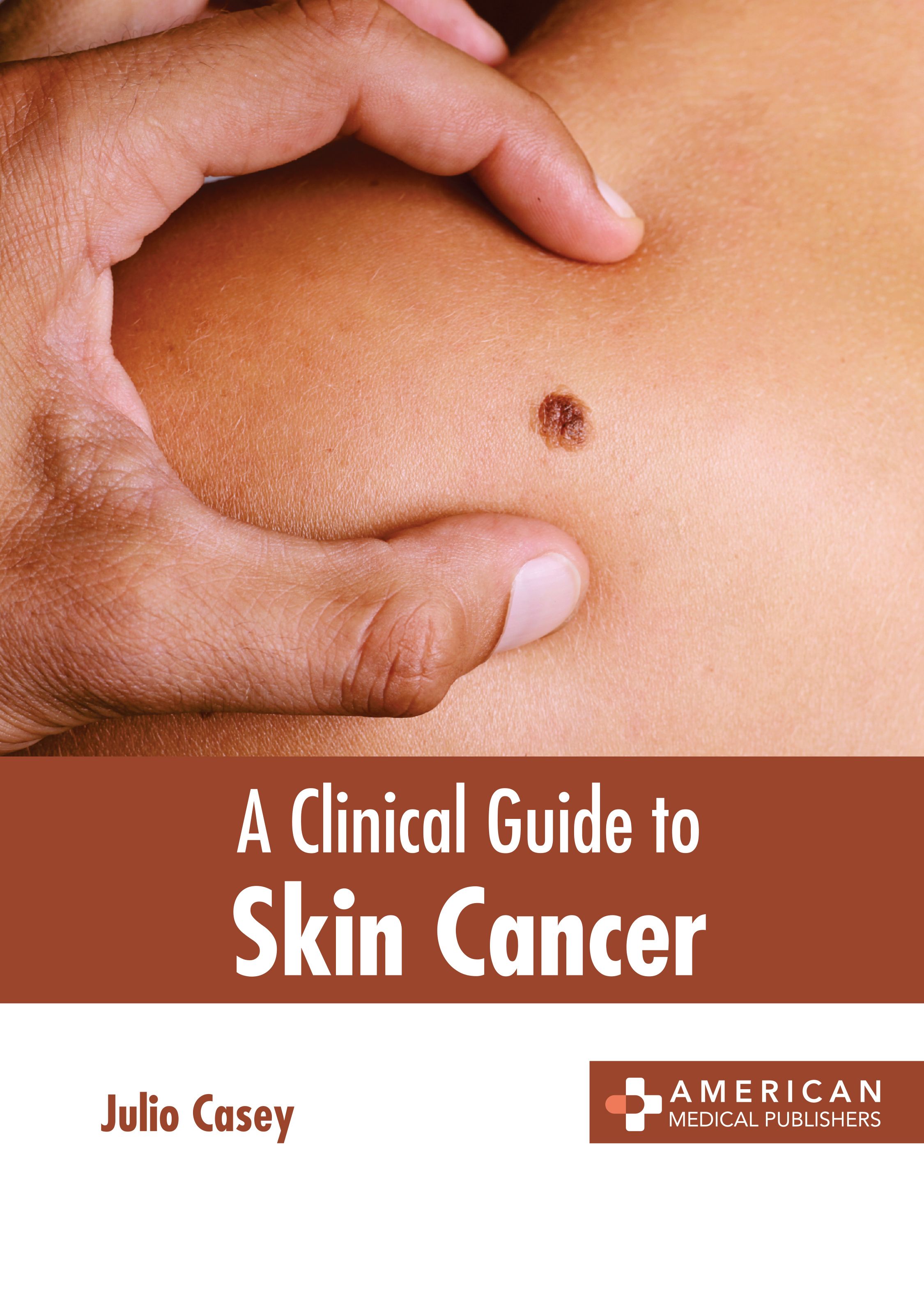 

exclusive-publishers/american-medical-publishers/a-clinical-guide-to-skin-cancer-9781639278411