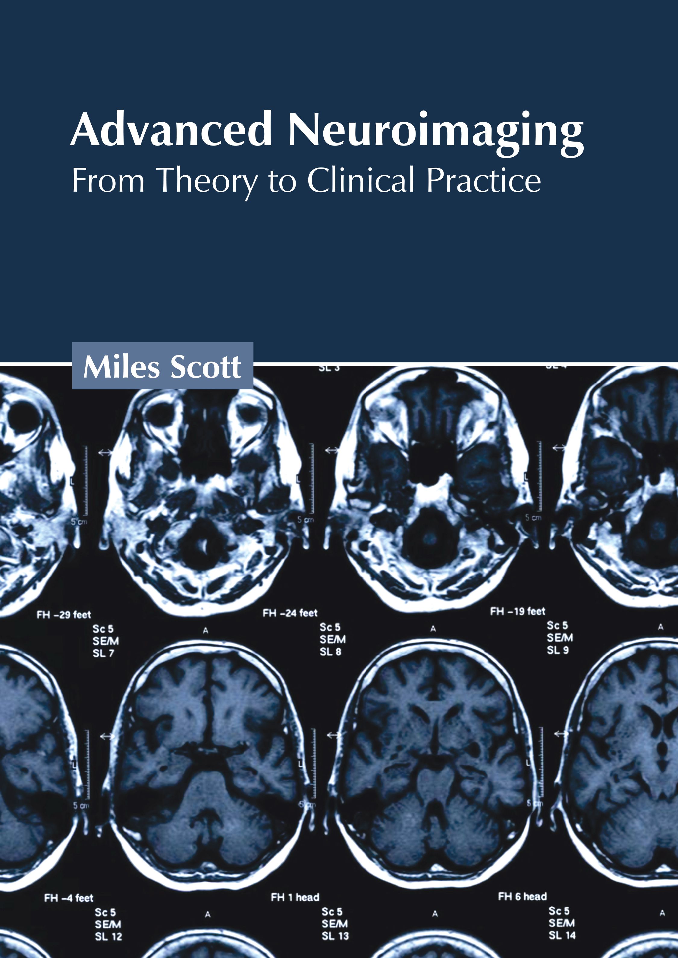 

exclusive-publishers/american-medical-publishers/advanced-neuroimaging-from-theory-to-clinical-practice-9781639278558