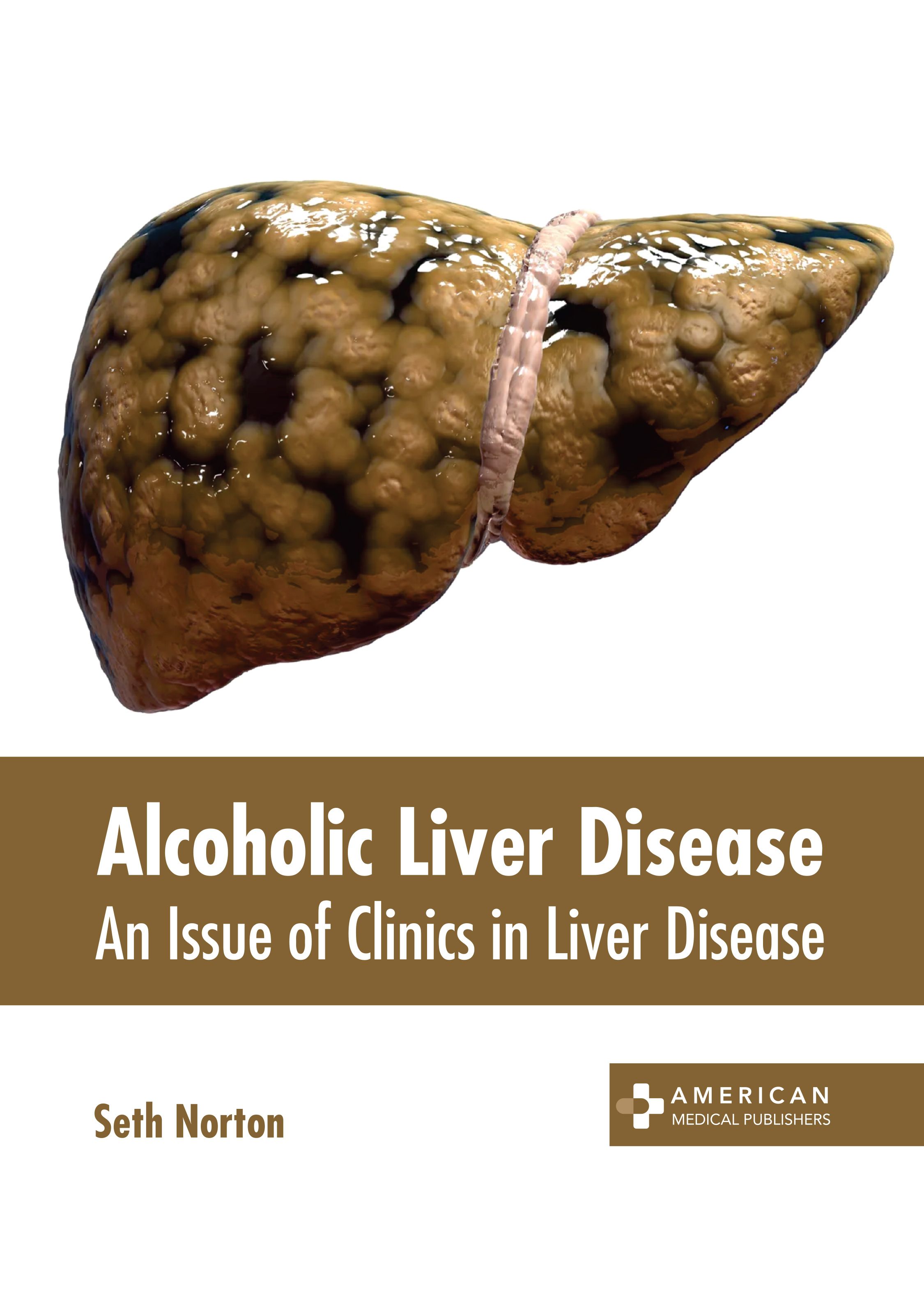 

medical-reference-books/gastroenterology/alcoholic-liver-disease-an-issue-of-clinics-in-liver-disease-9781639278640