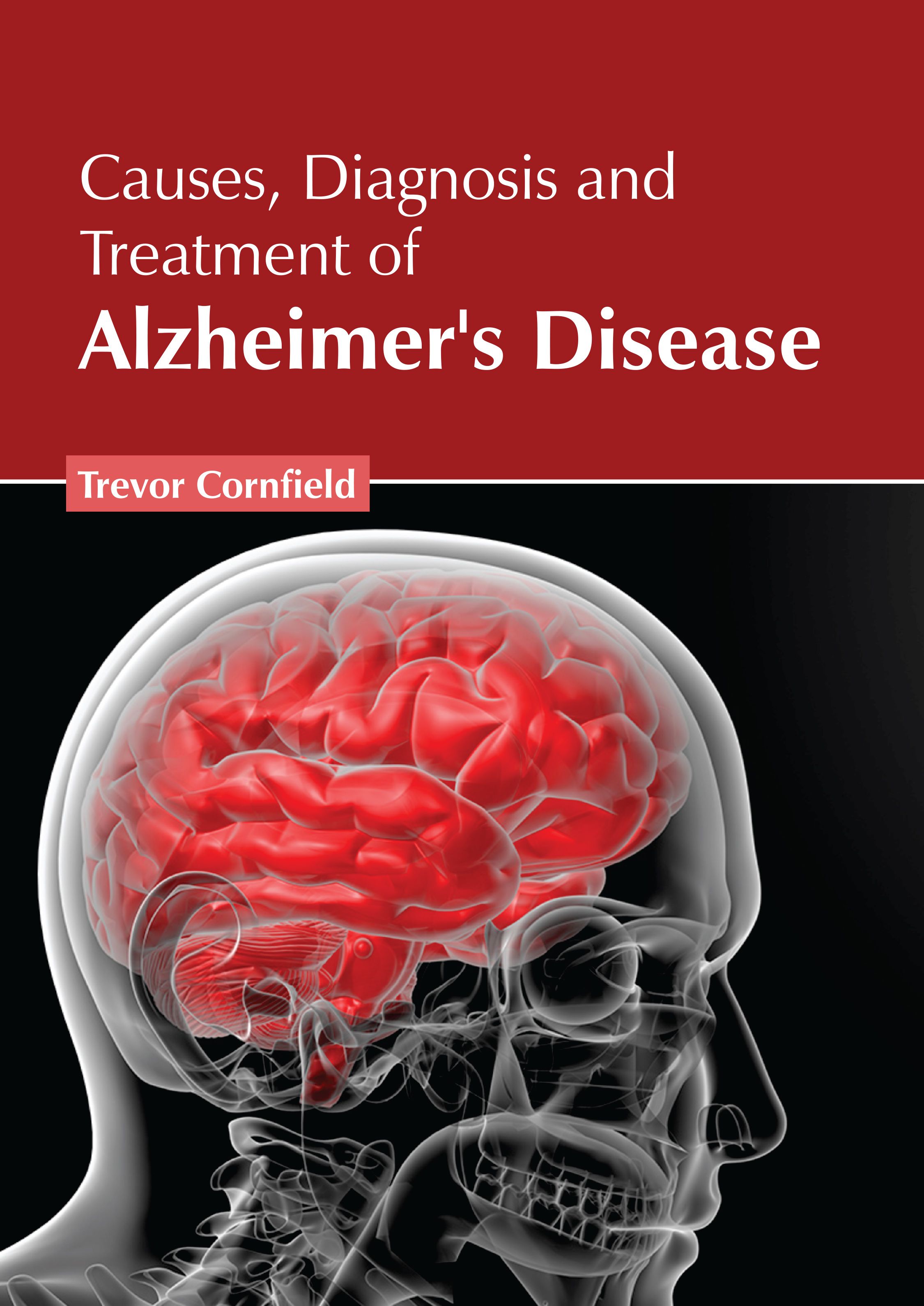 

exclusive-publishers/american-medical-publishers/causes-diagnosis-and-treatment-of-alzheimer-s-disease-9781639278657