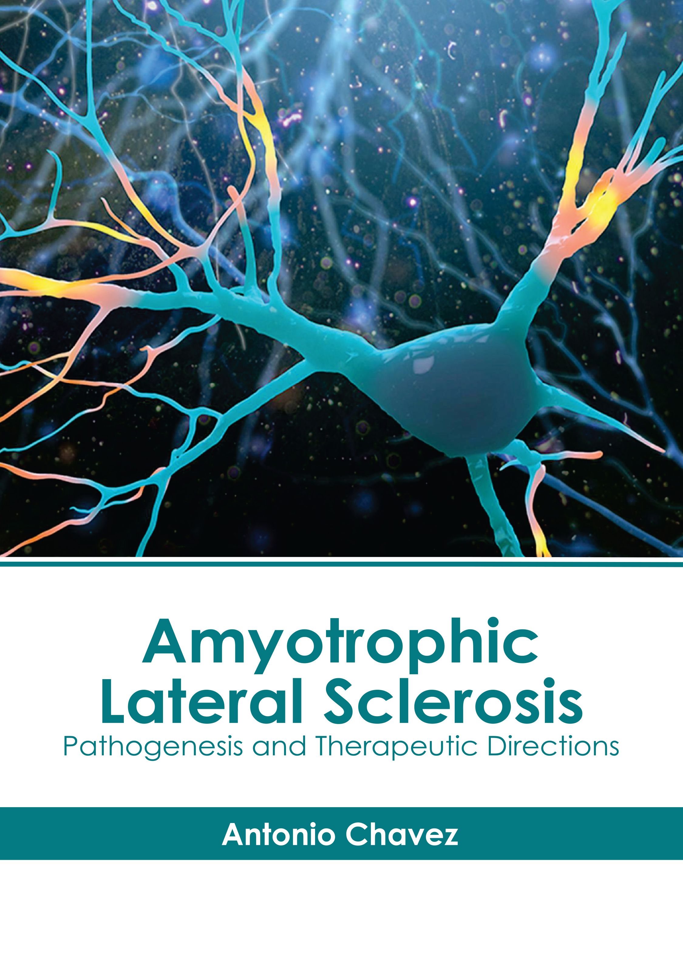 

exclusive-publishers/american-medical-publishers/amyotrophic-lateral-sclerosis-pathogenesis-and-therapeutic-directions-9781639278688