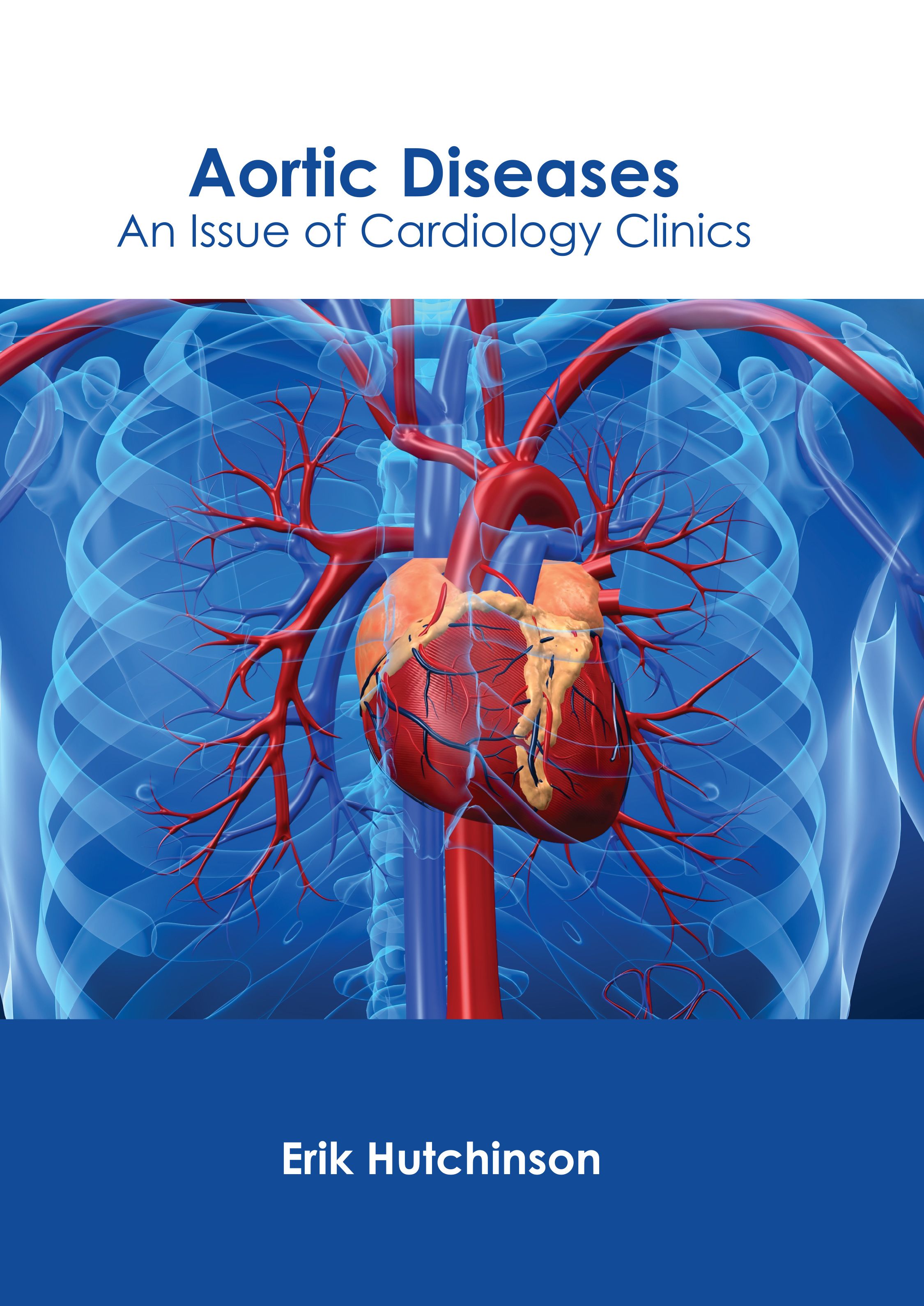 

exclusive-publishers/american-medical-publishers/aortic-diseases-an-issue-of-cardiology-clinics-9781639278923