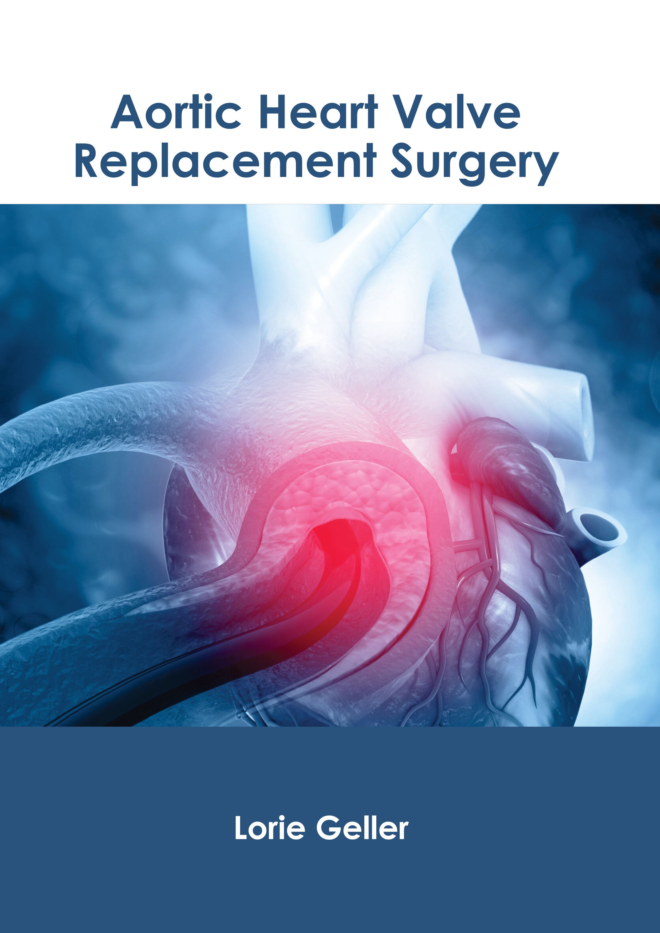 

medical-reference-books/surgery/aortic-heart-valve-replacement-surgery-9781639278930