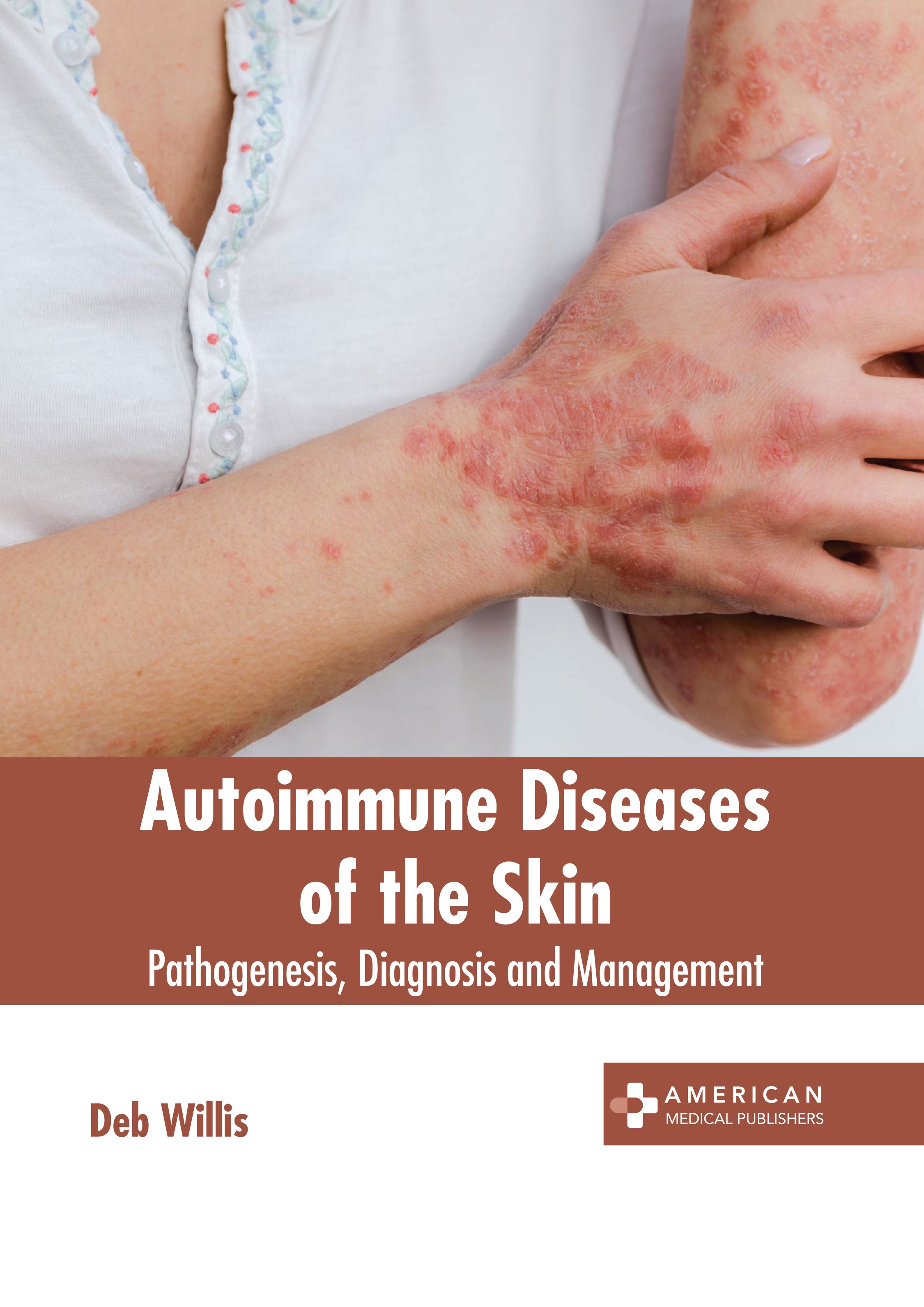 exclusive-publishers/american-medical-publishers/autoimmune-diseases-of-the-skin-pathogenesis-diagnosis-and-management-9781639279036
