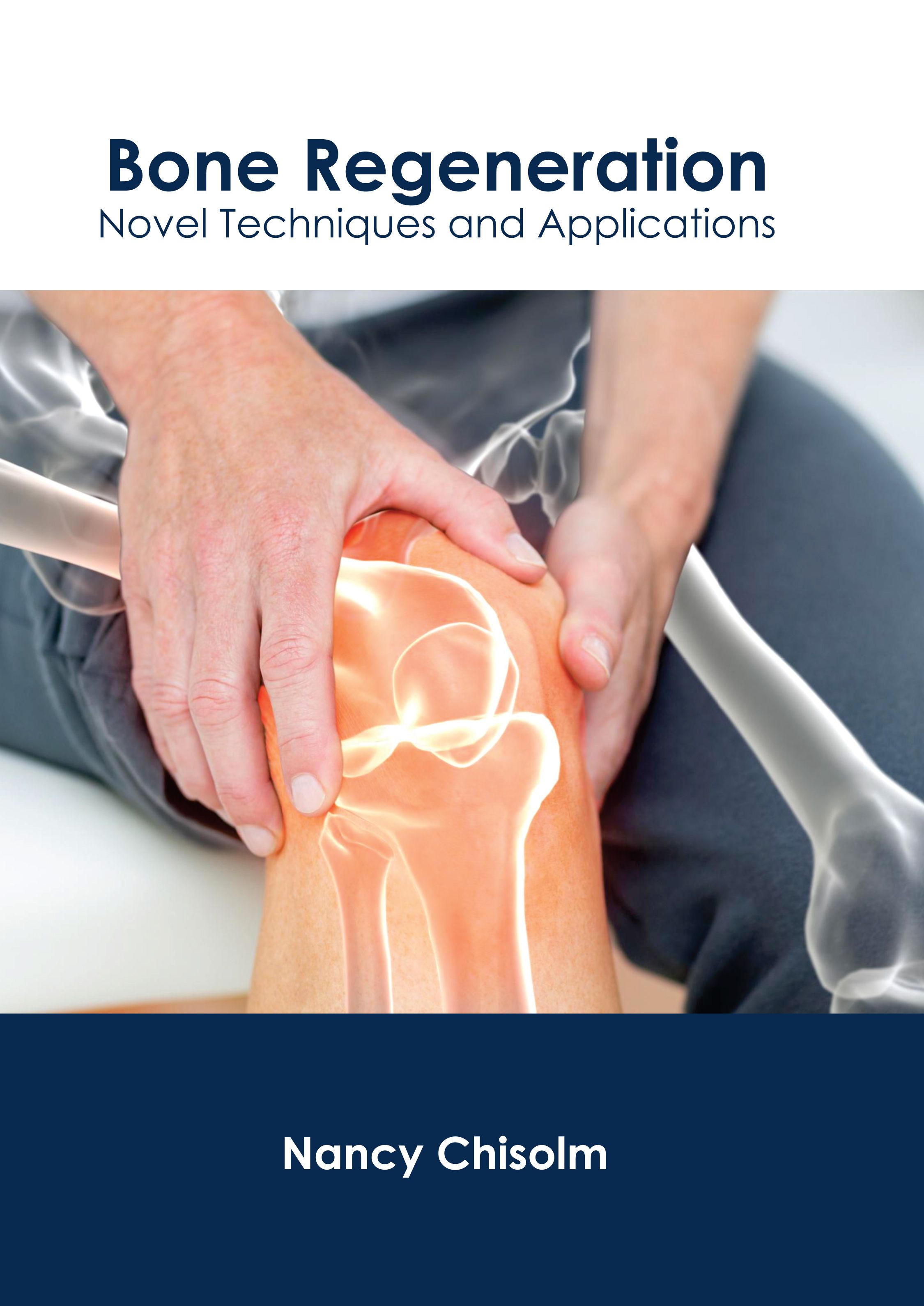 

exclusive-publishers/american-medical-publishers/bone-regeneration-novel-techniques-and-applications-9781639279418