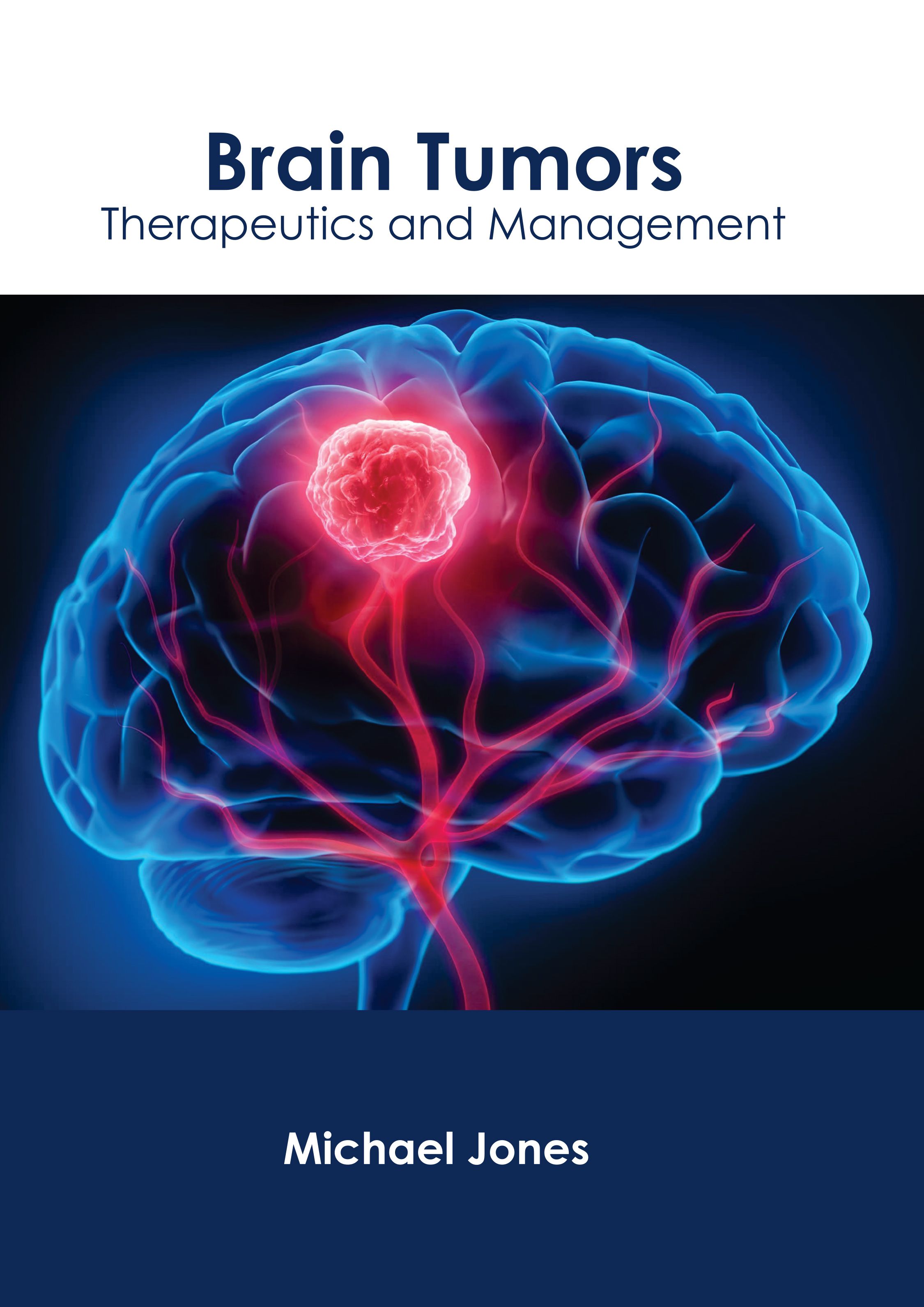 

exclusive-publishers/american-medical-publishers/brain-tumors-therapeutics-and-management-9781639279449