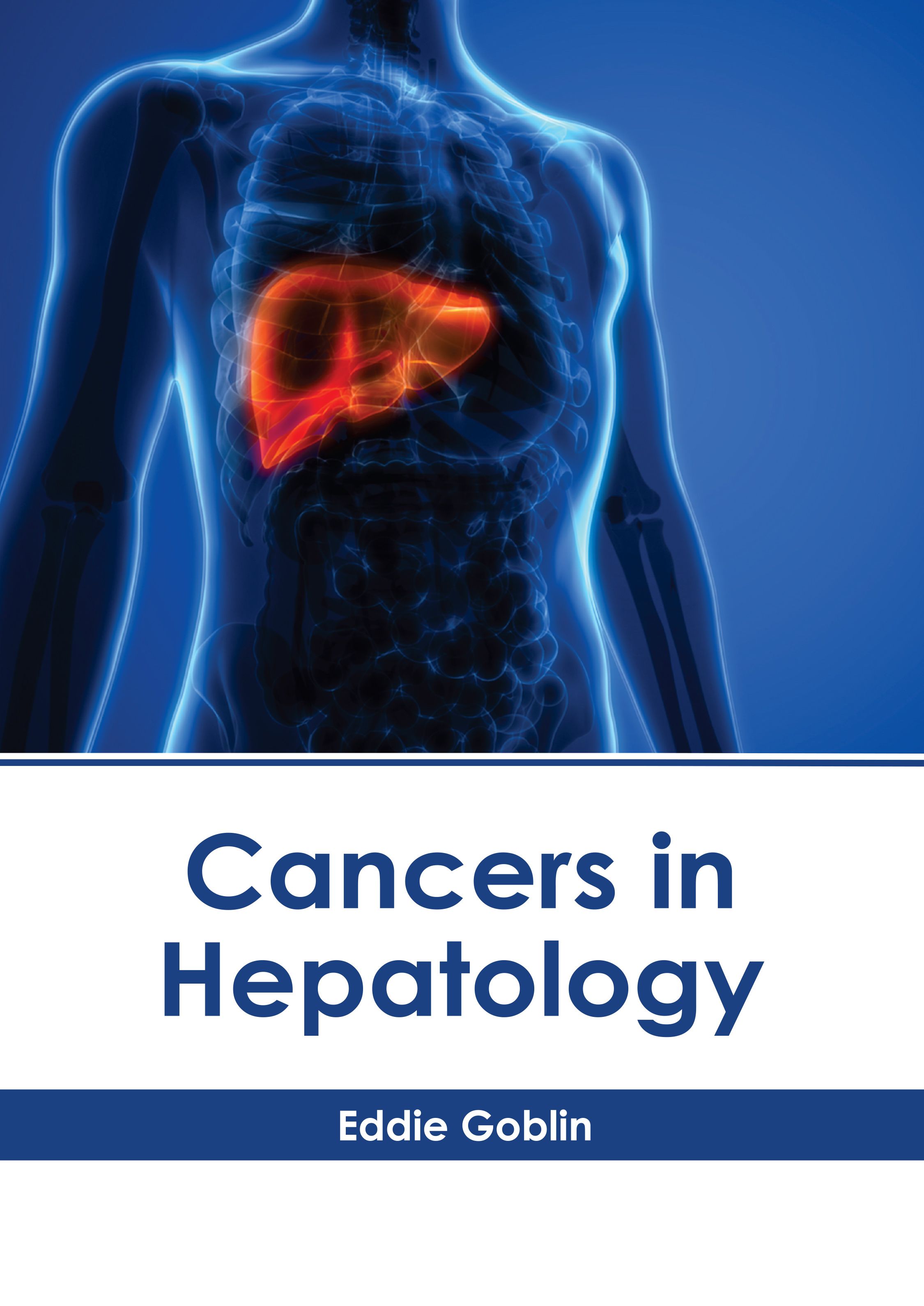 

exclusive-publishers/american-medical-publishers/cancers-in-hepatology-9781639279562