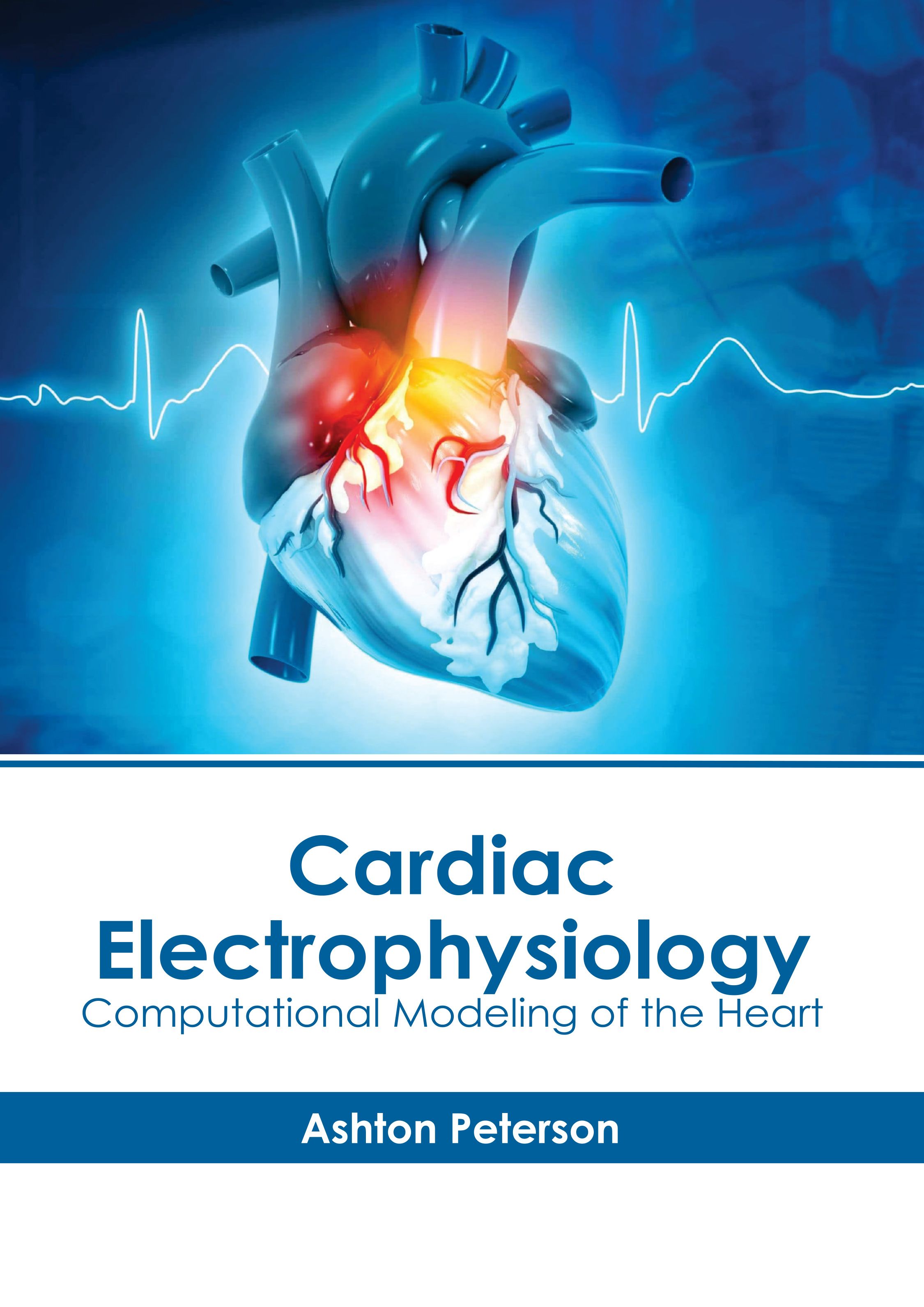 

exclusive-publishers/american-medical-publishers/cardiac-electrophysiology-computational-modeling-of-the-heart-9781639279593