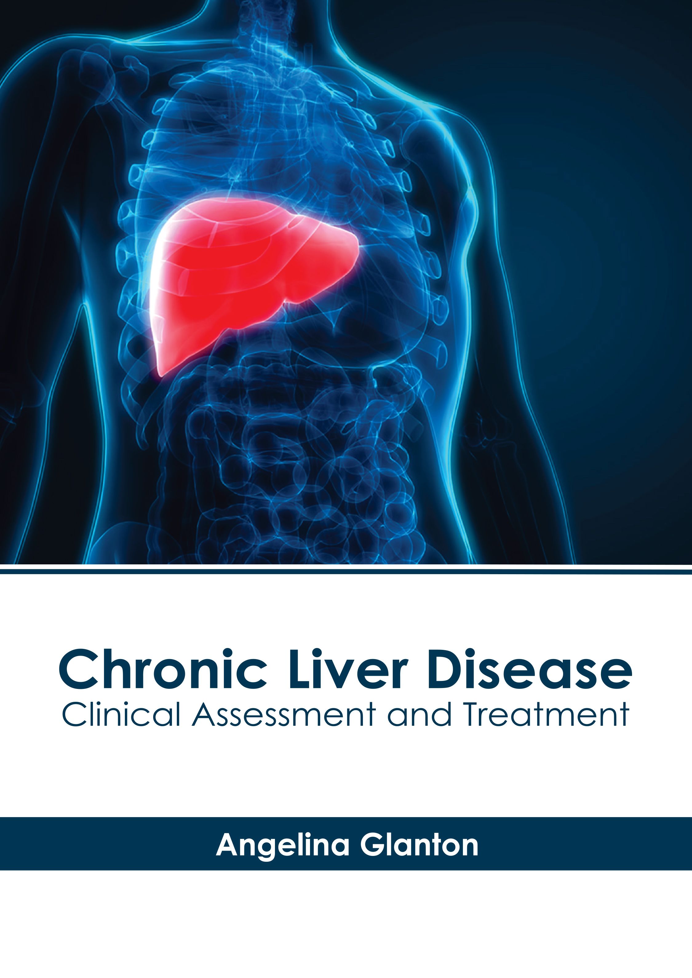 

exclusive-publishers/american-medical-publishers/chronic-liver-disease-clinical-assessment-and-treatment-9781639279807