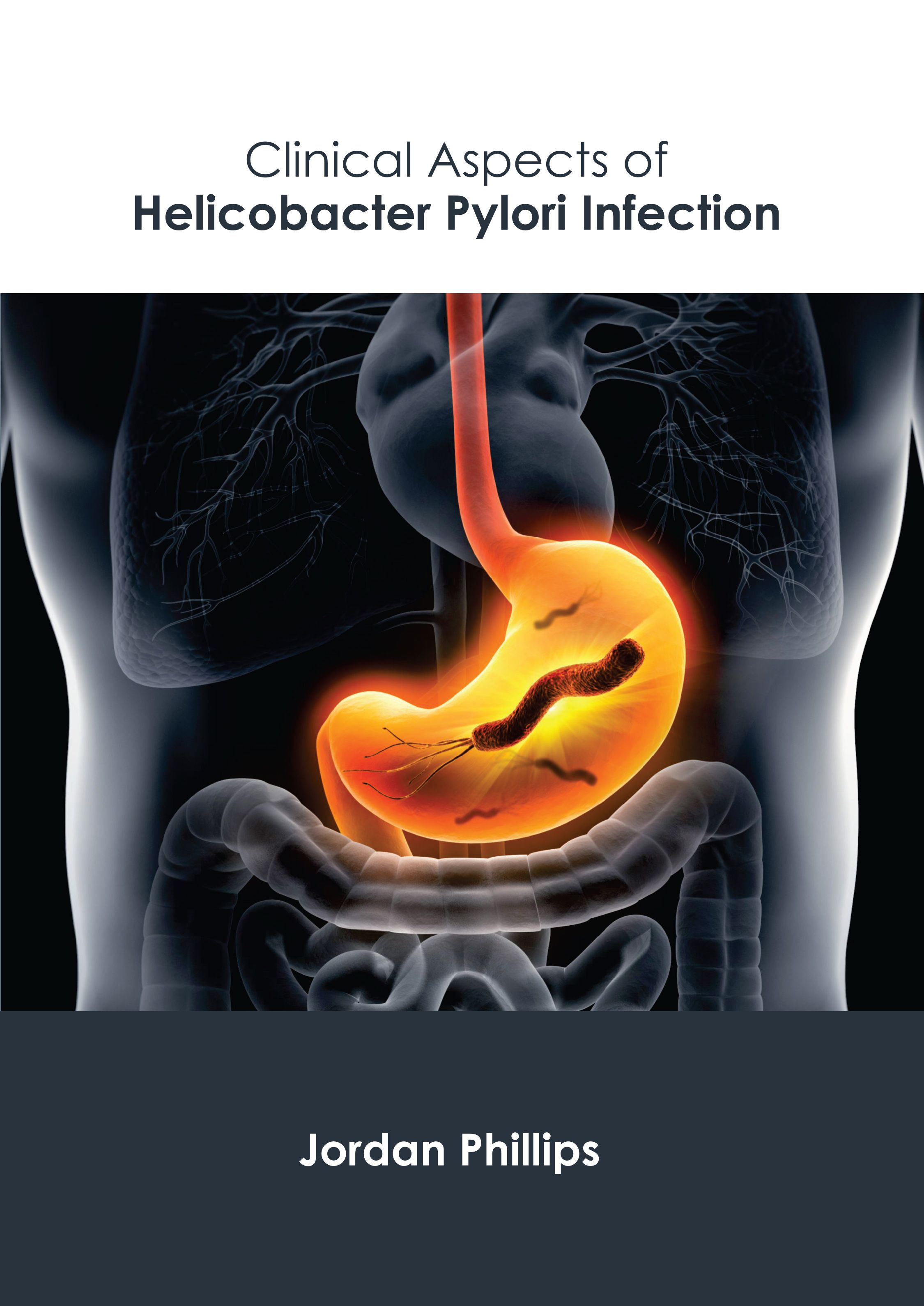 

exclusive-publishers/american-medical-publishers/clinical-aspects-of-helicobacter-pylori-infection-9781639279852