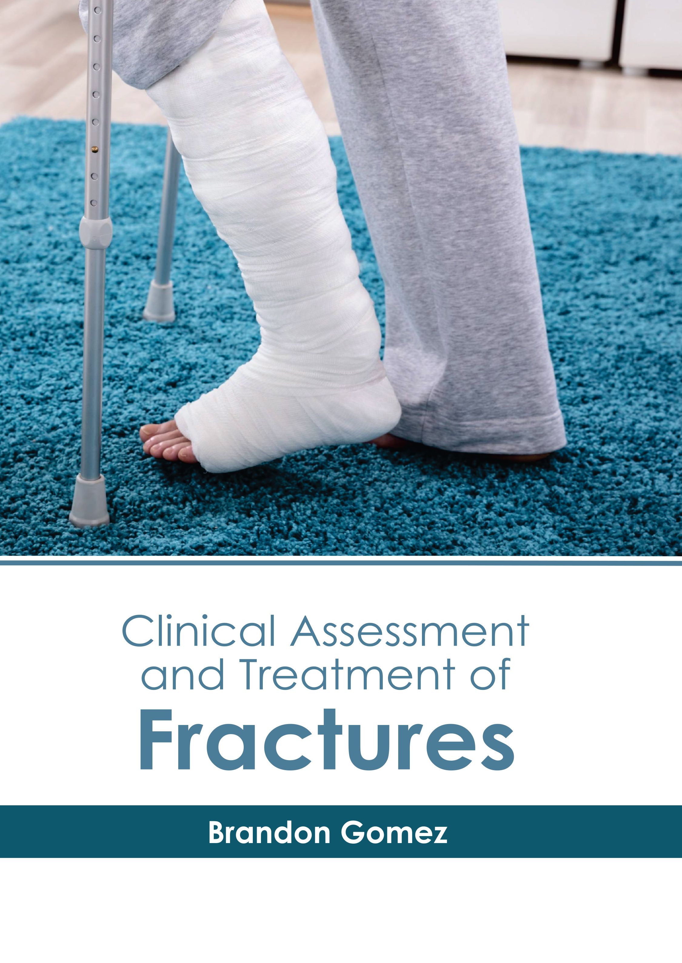 

exclusive-publishers/american-medical-publishers/clinical-assessment-and-treatment-of-fractures-9781639279906