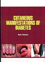 

surgical-sciences/nephrology/cutaneous-manifestations-of-diabetes-hb--9781644350164