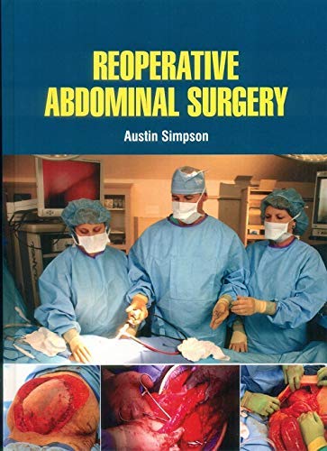 

surgical-sciences/surgery/reoperative-abdominal-surgery-9781644351208